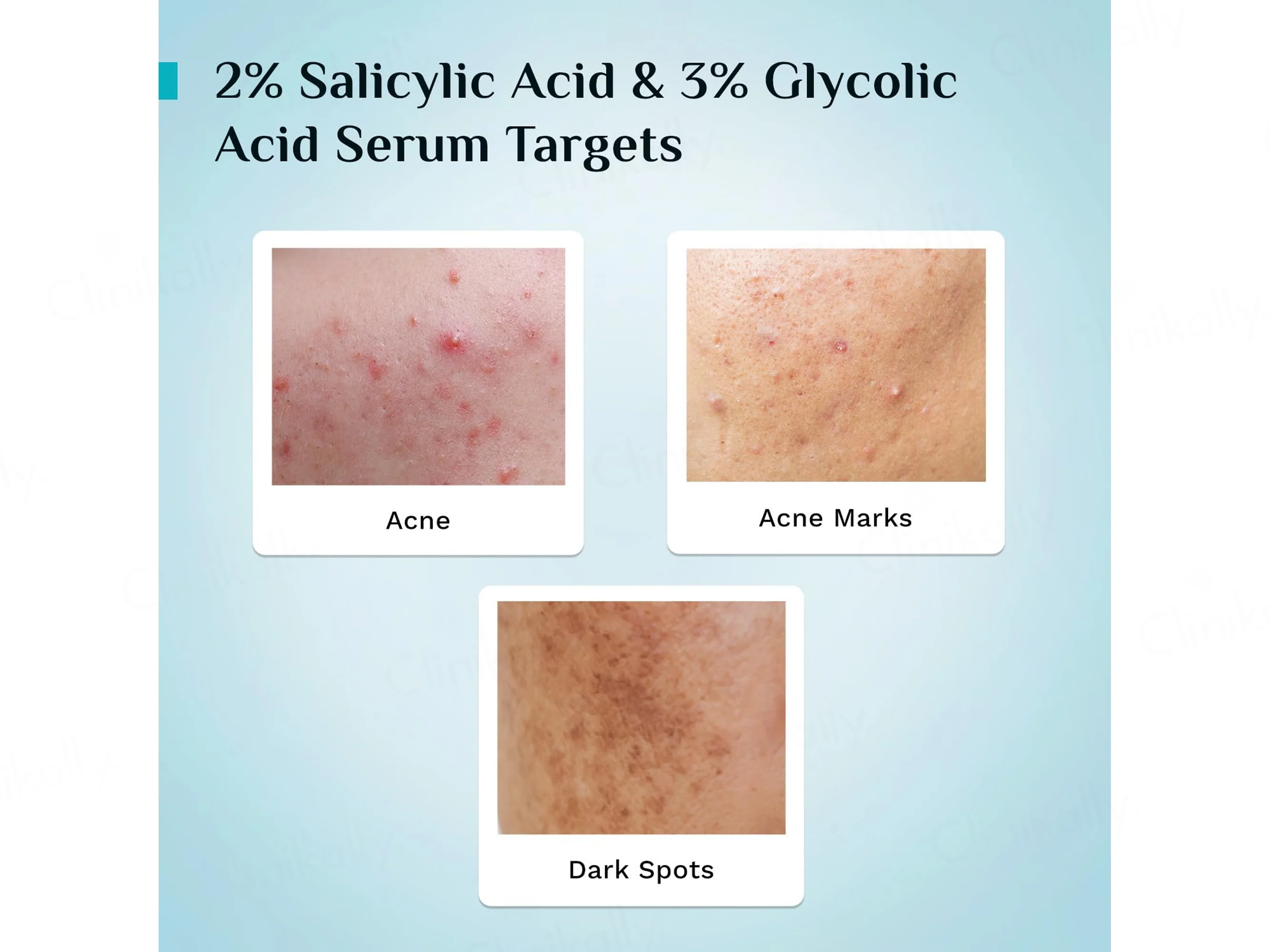 Pilgrim Salicylic & Glycolic Acid Anti-Acne Serum - Image 4