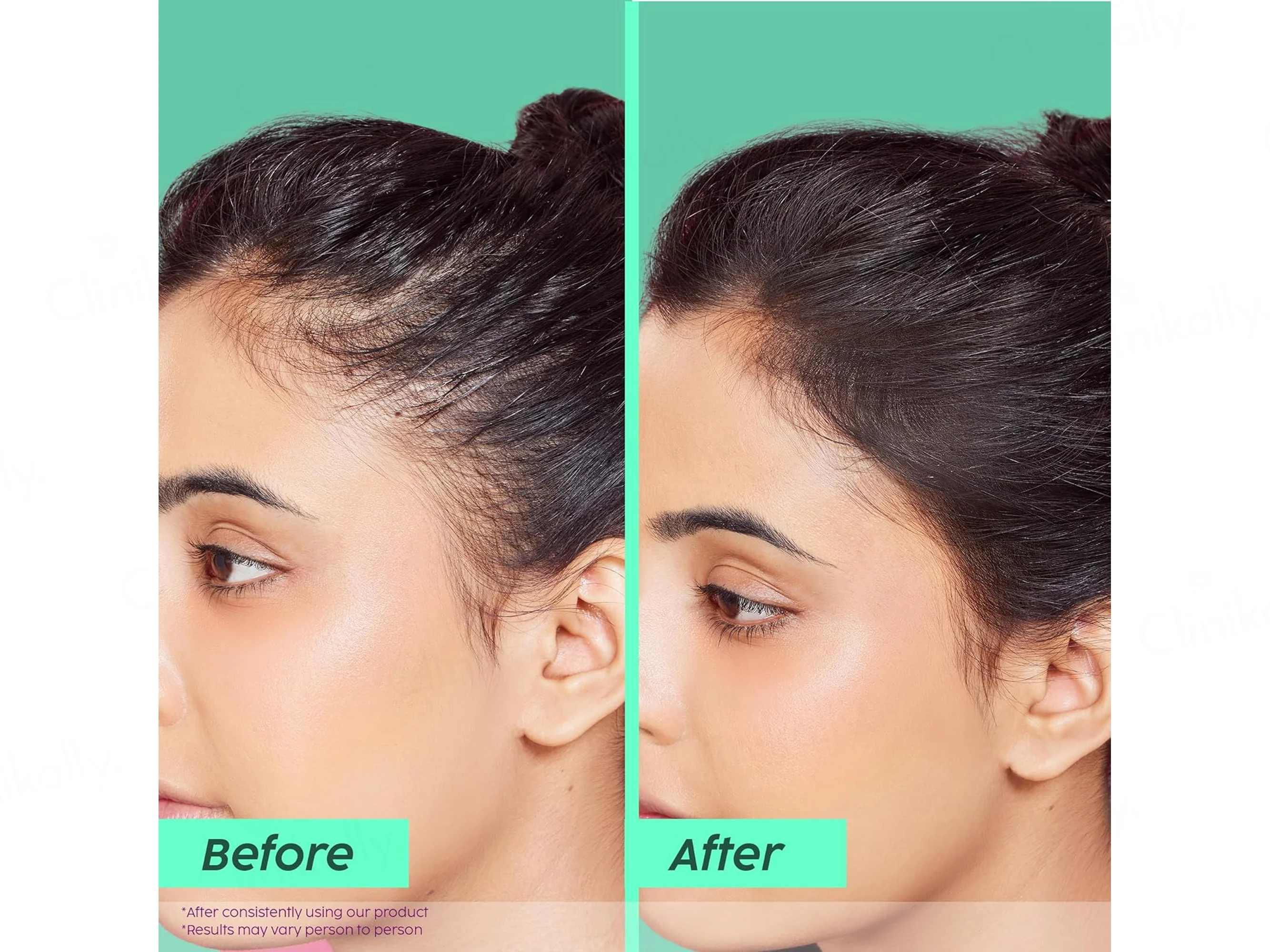 Plix Rosemary Anti-Hair Fall Advancved Shampoo - Image 3