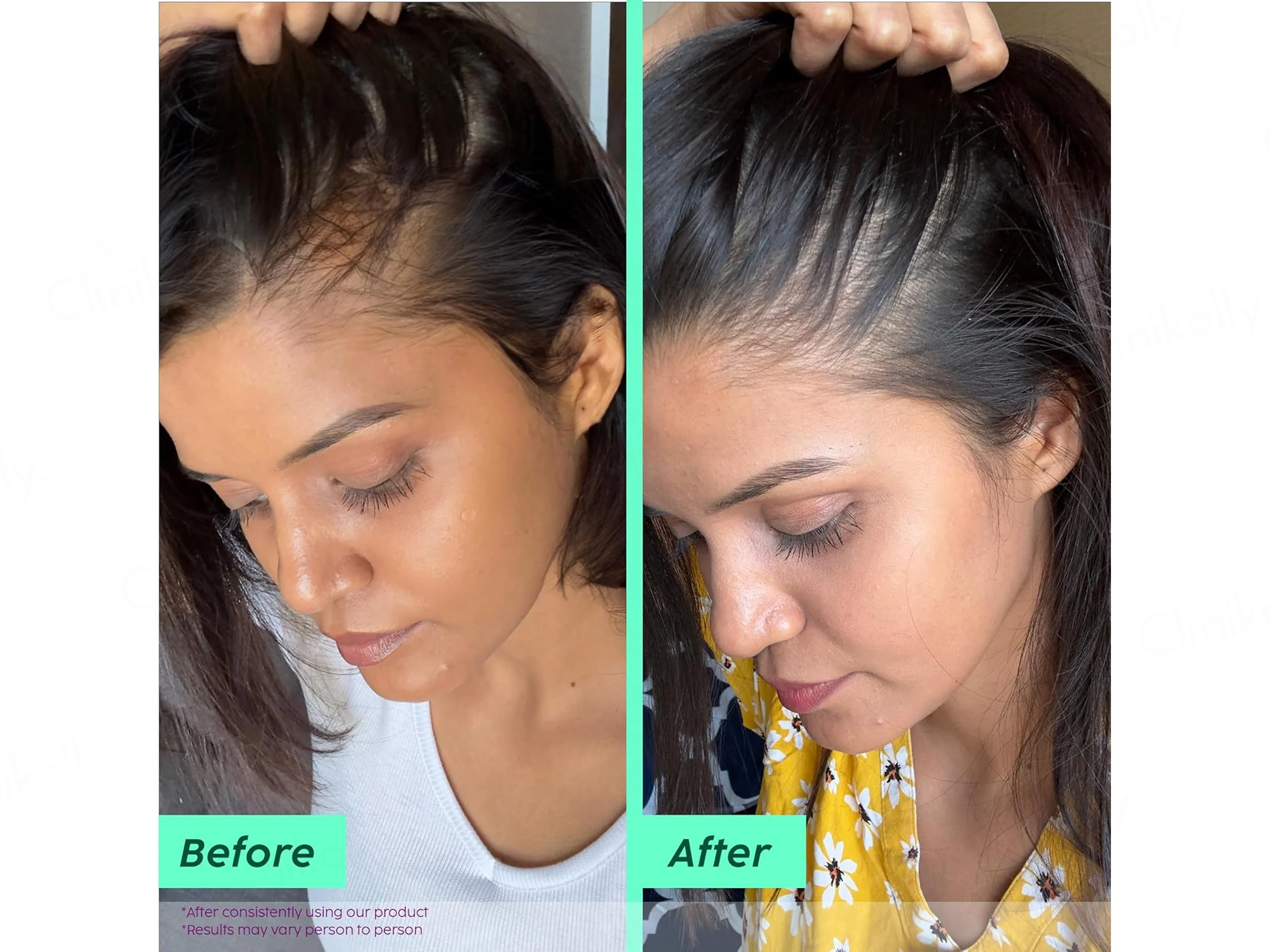 Plix Rosemary Anti-Hair Fall Advancved Shampoo - Image 4