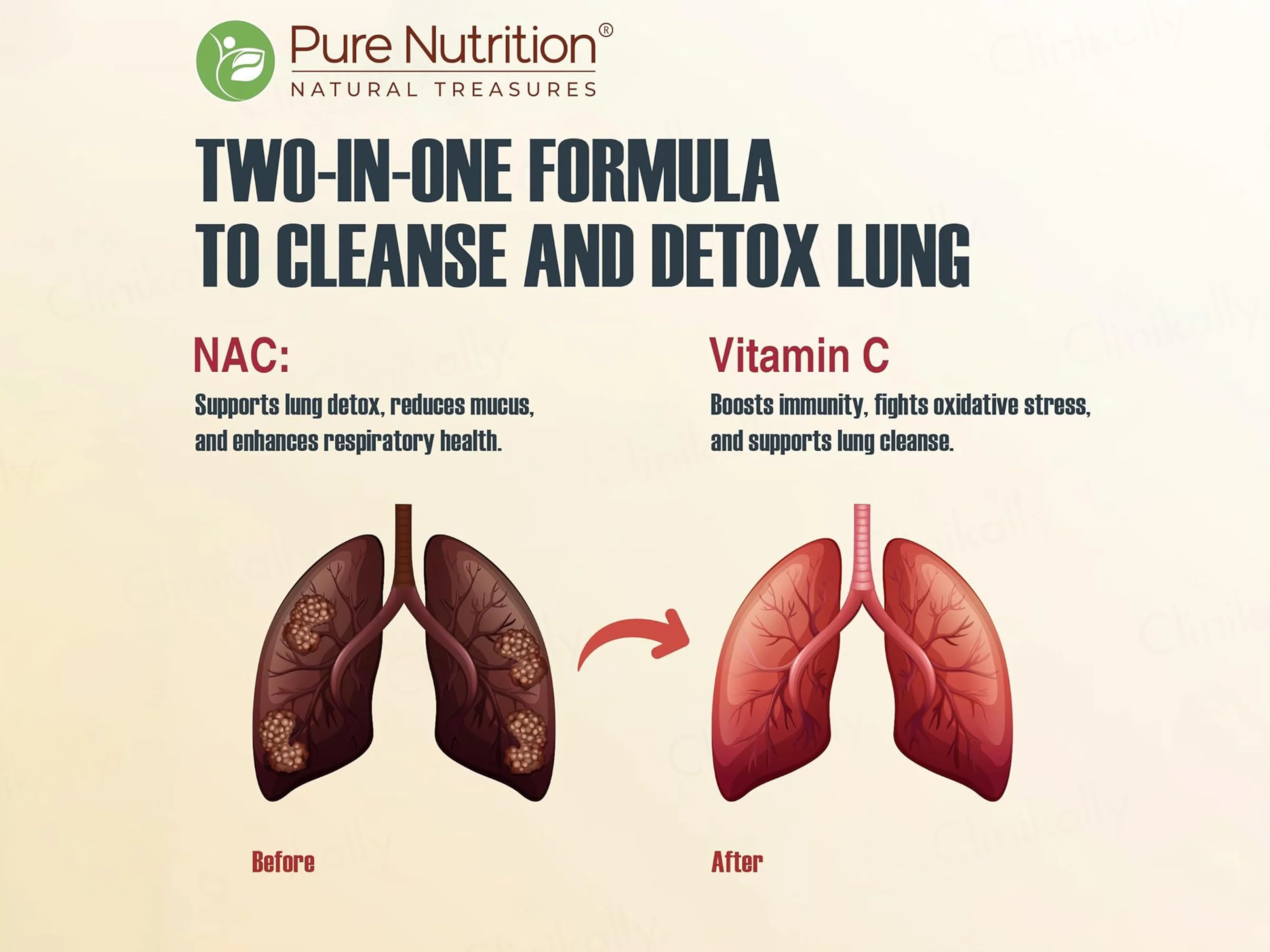Pure Nutrition Lung Detox Effervescent Tablet - Lime Lemon Flavour - Image 4
