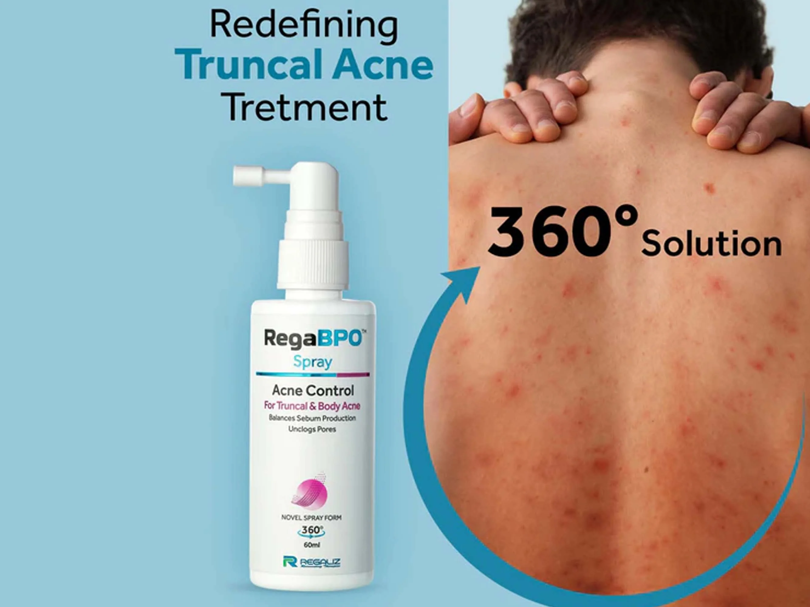 Rega-BPO Acne Control Body Spray - Image 4