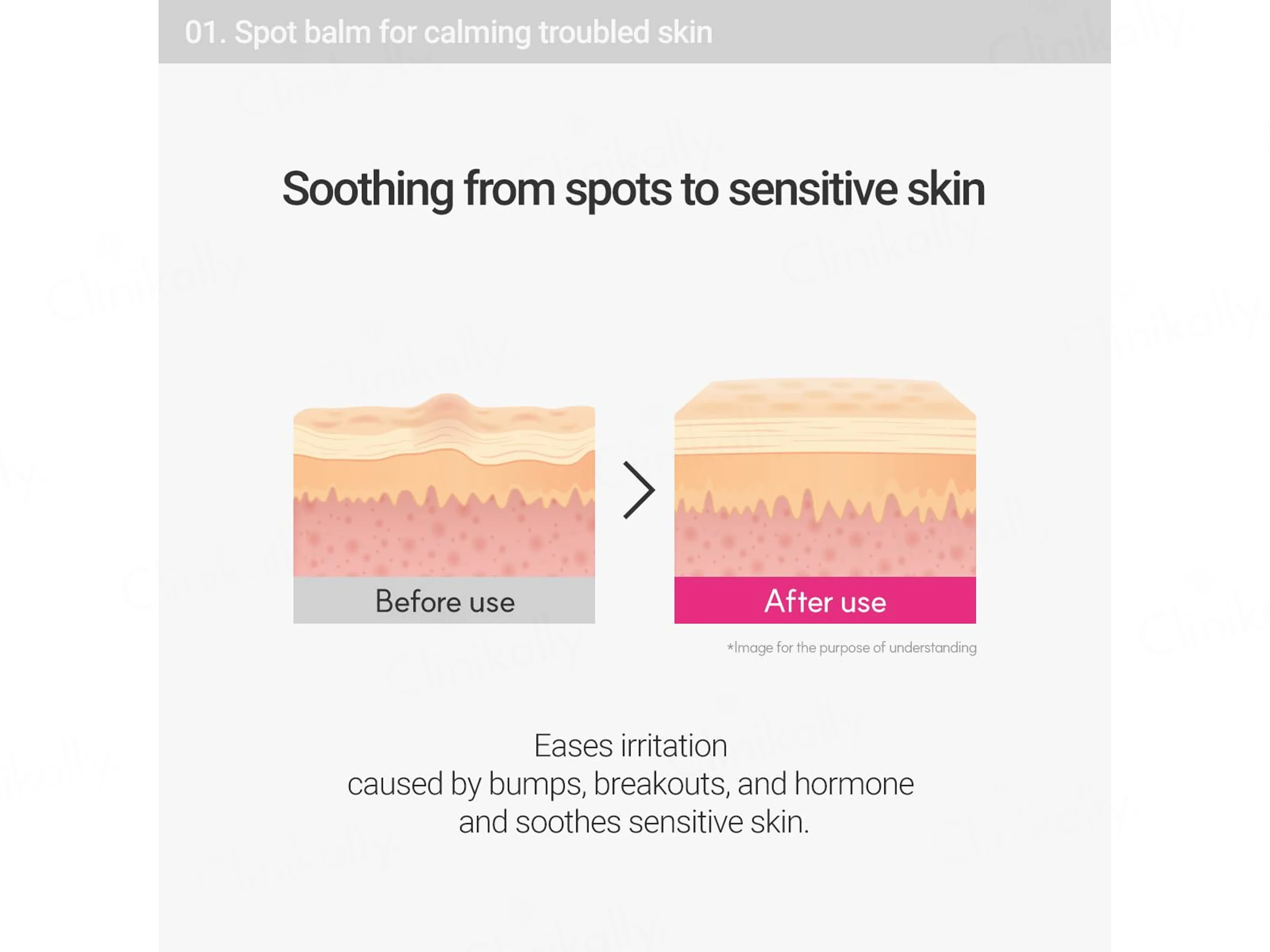 Rovectin Cica Care Spot Balm - Image 5