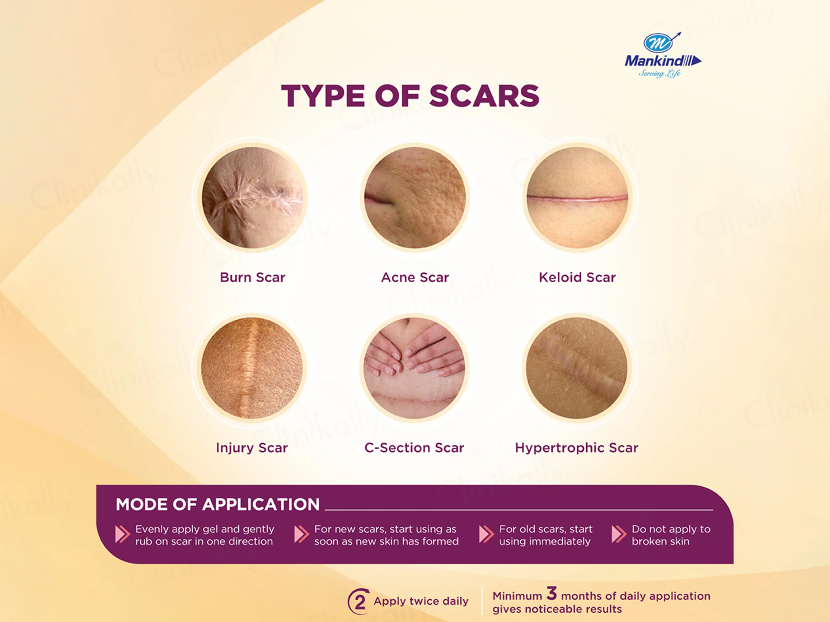 ScarEnd Silicone Gel - Image 6