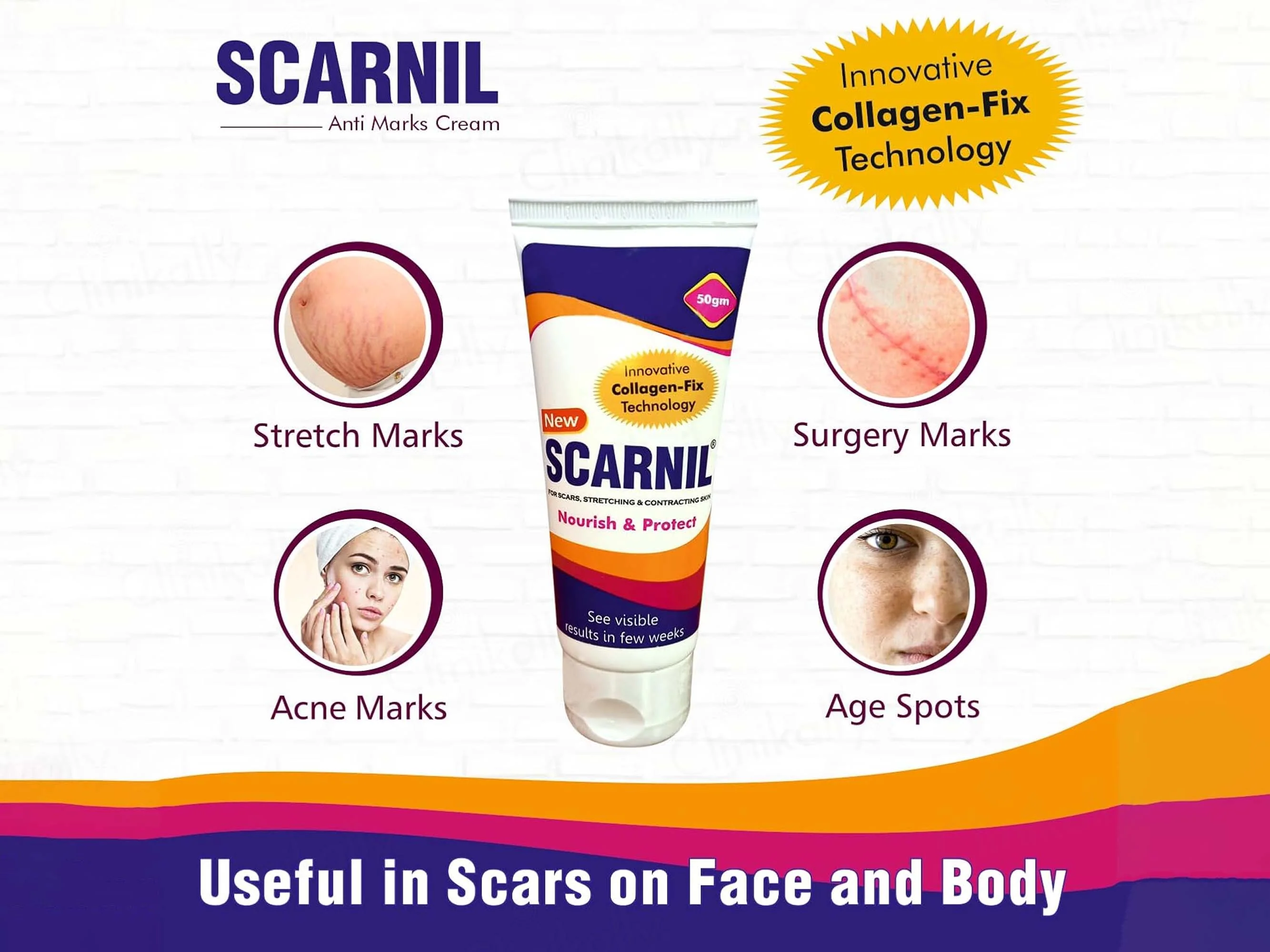 Scarnil Stretch Mark & Scar Therapy Cream - Image 2