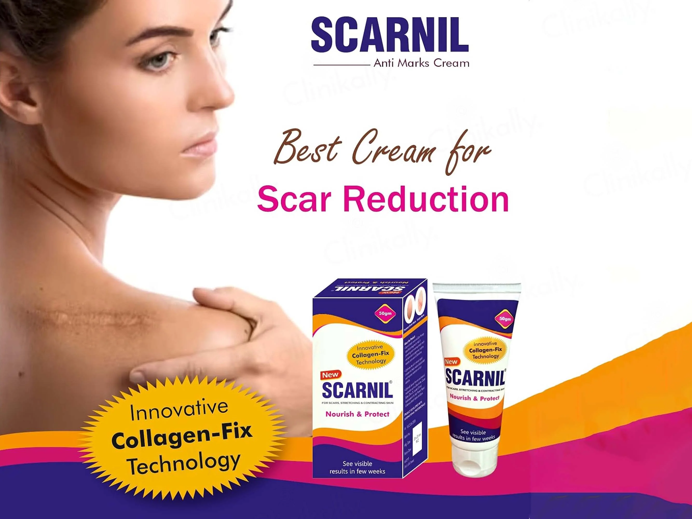 Scarnil Stretch Mark & Scar Therapy Cream - Image 4
