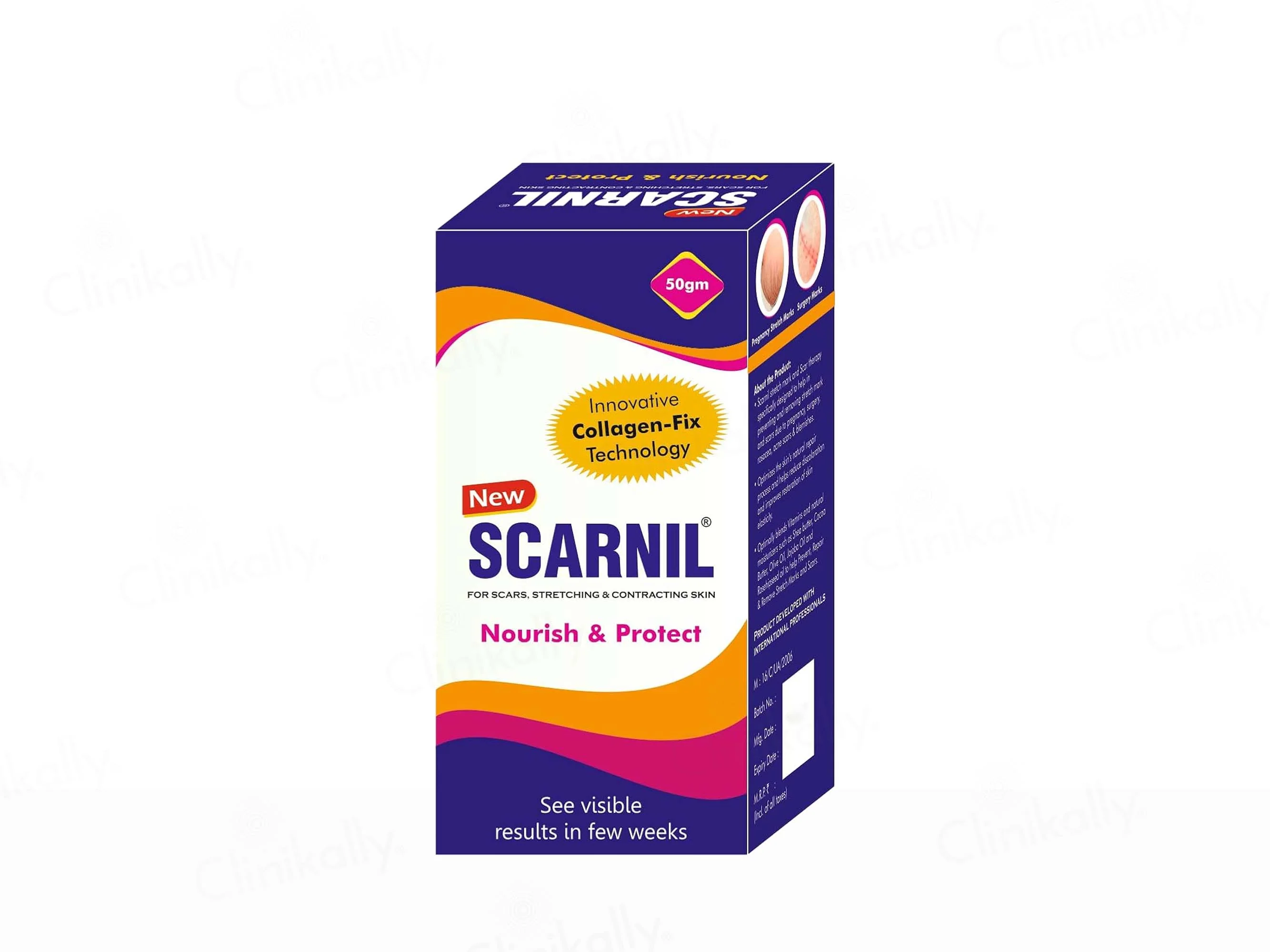Scarnil Stretch Mark & Scar Therapy Cream - Image 6