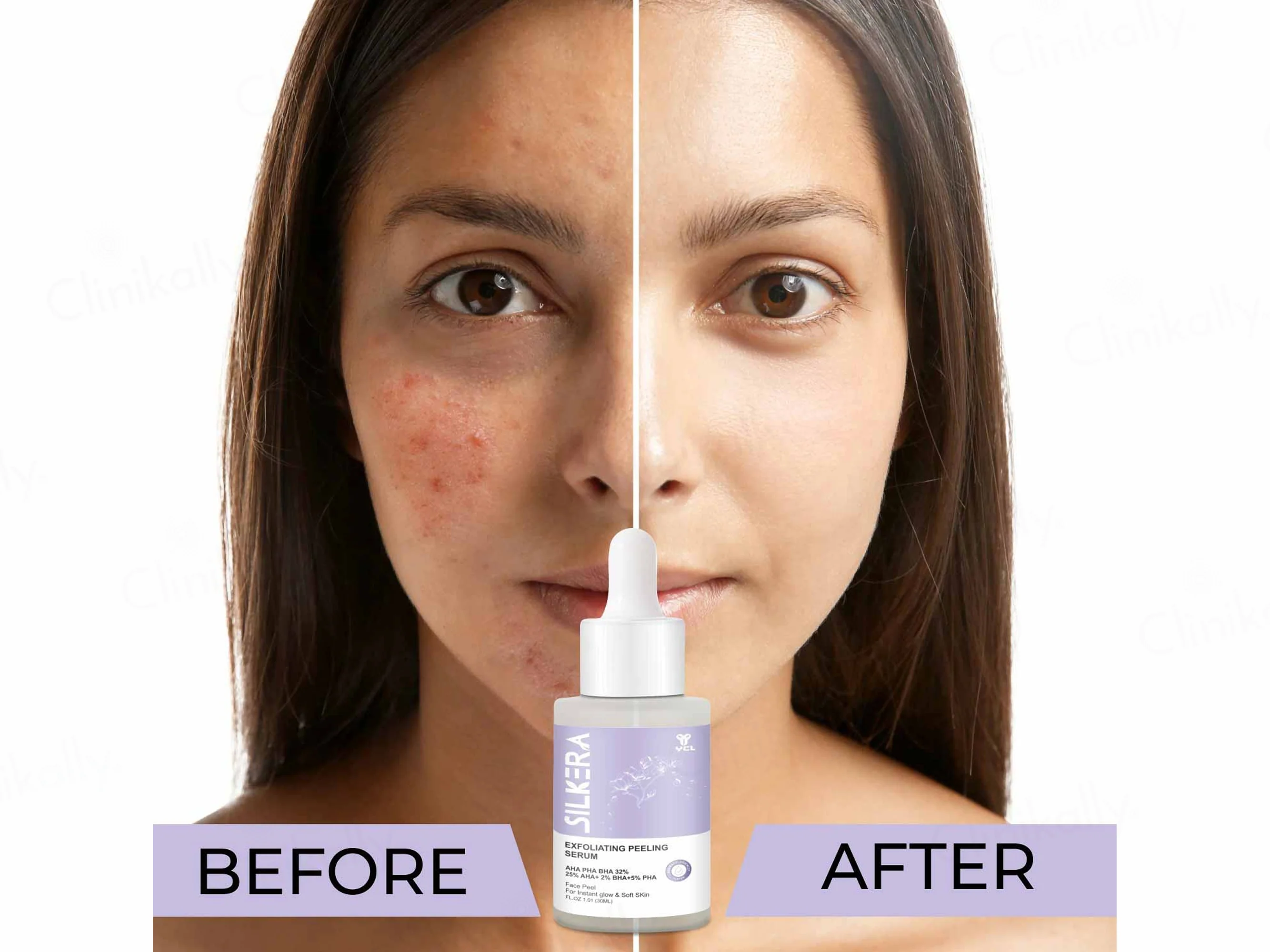 Silkera Exfoliating Peeling Serum - Image 7