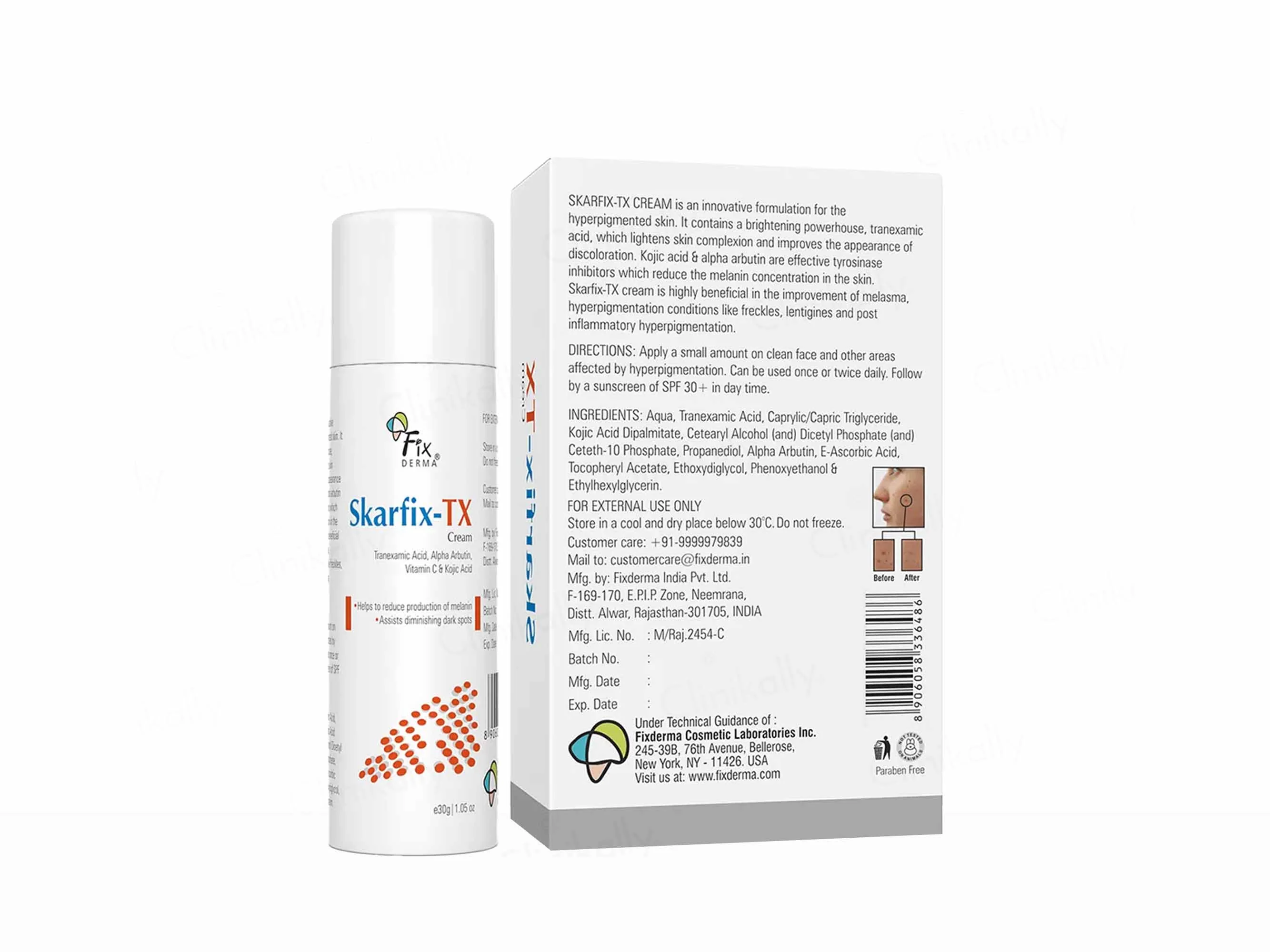 Skarfix-TX Cream - Image 5