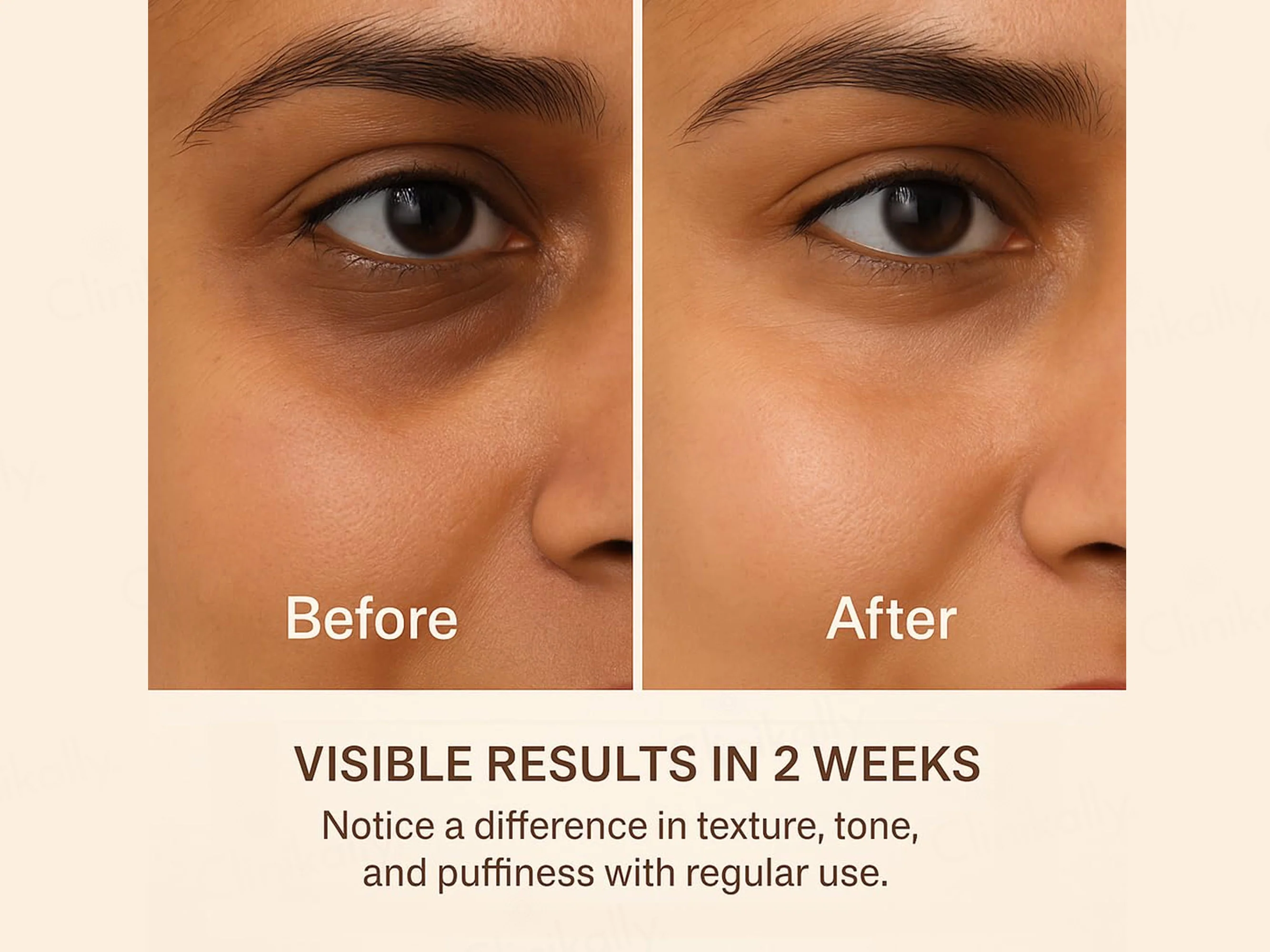 SKOG FER Under Eye Repair Oil - Image 5