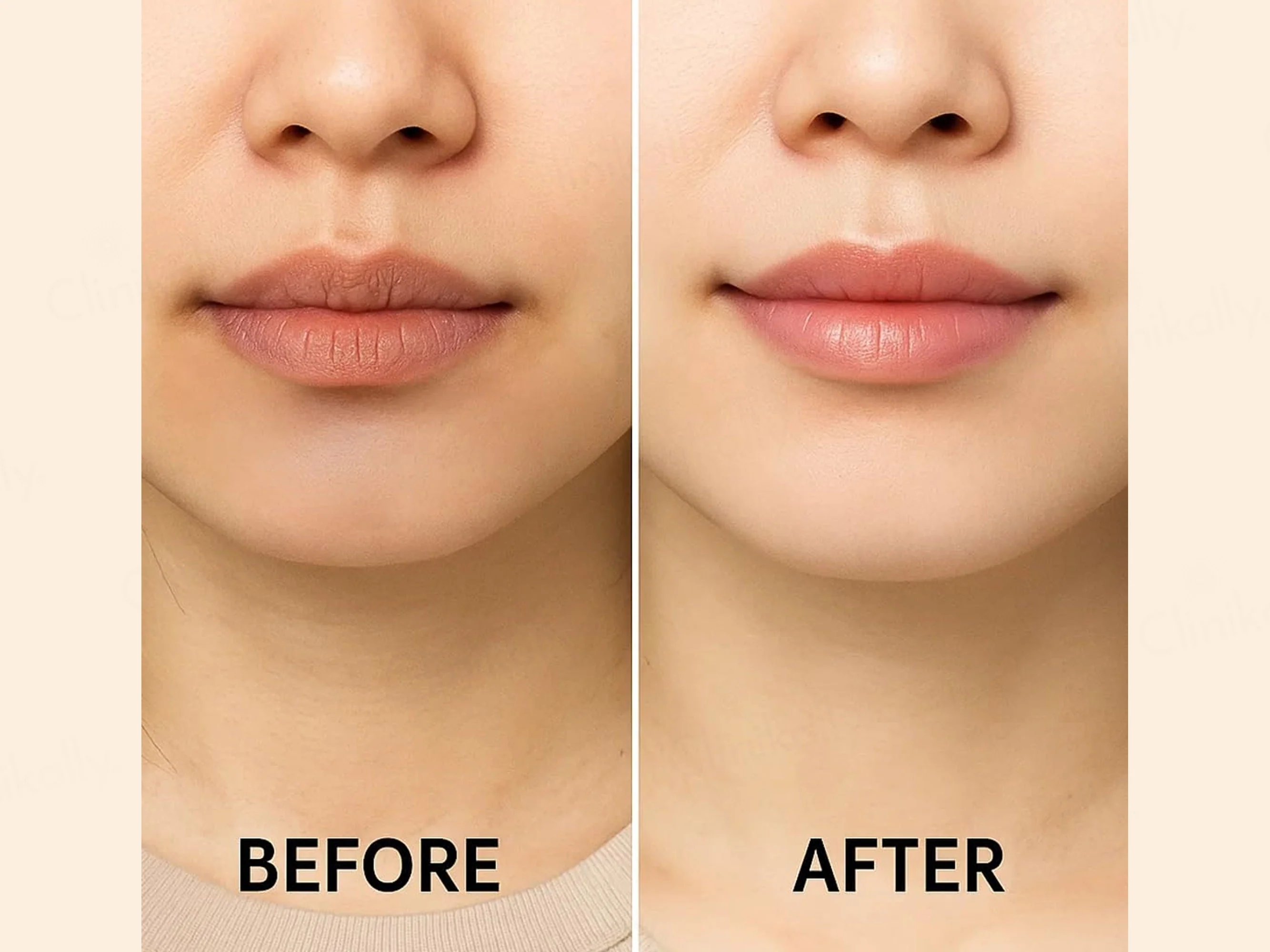 SKOG FLR Lip Repair Oil - Image 5