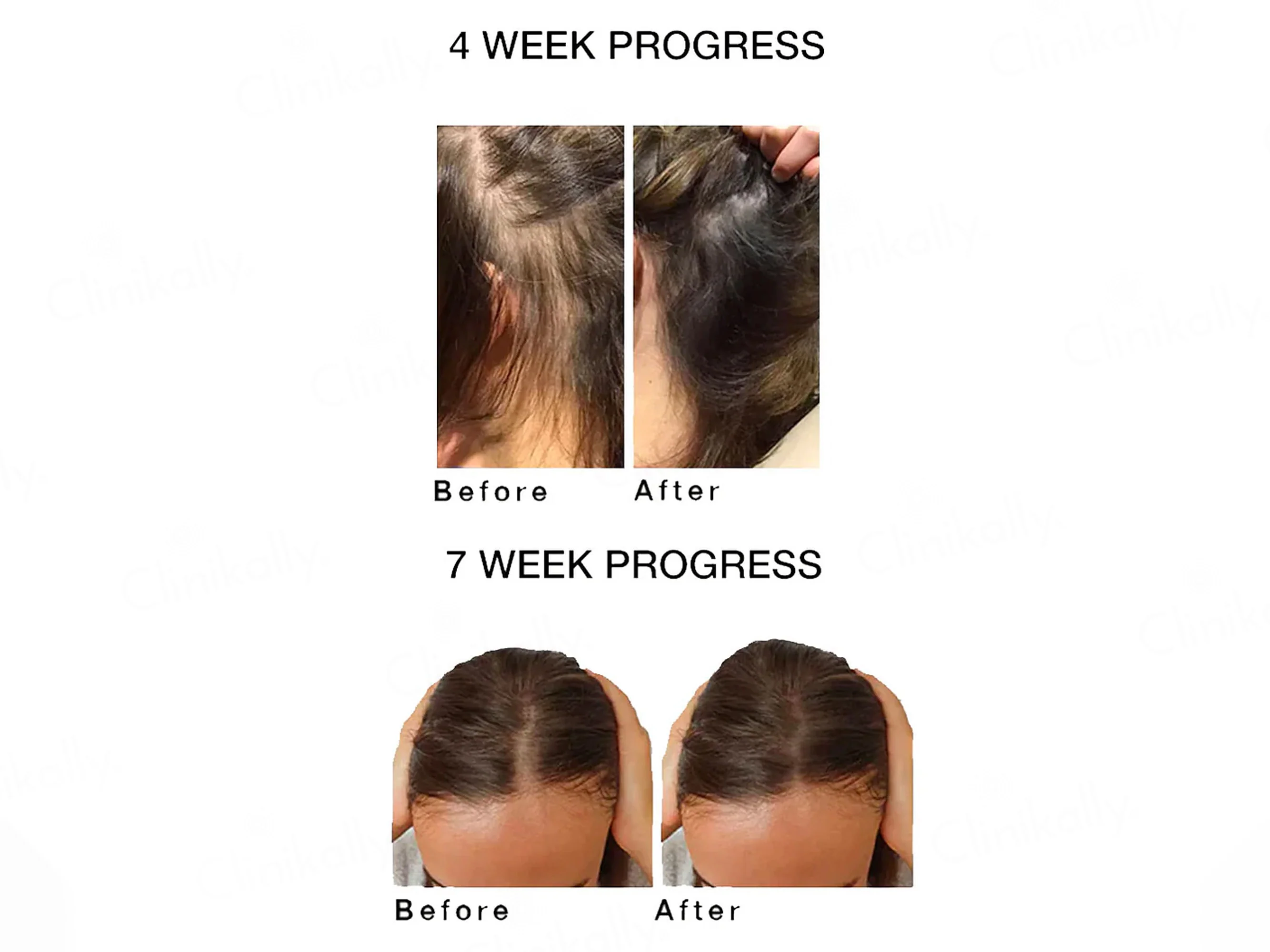 SKOG HR Super Hair Repair Oil - Image 5
