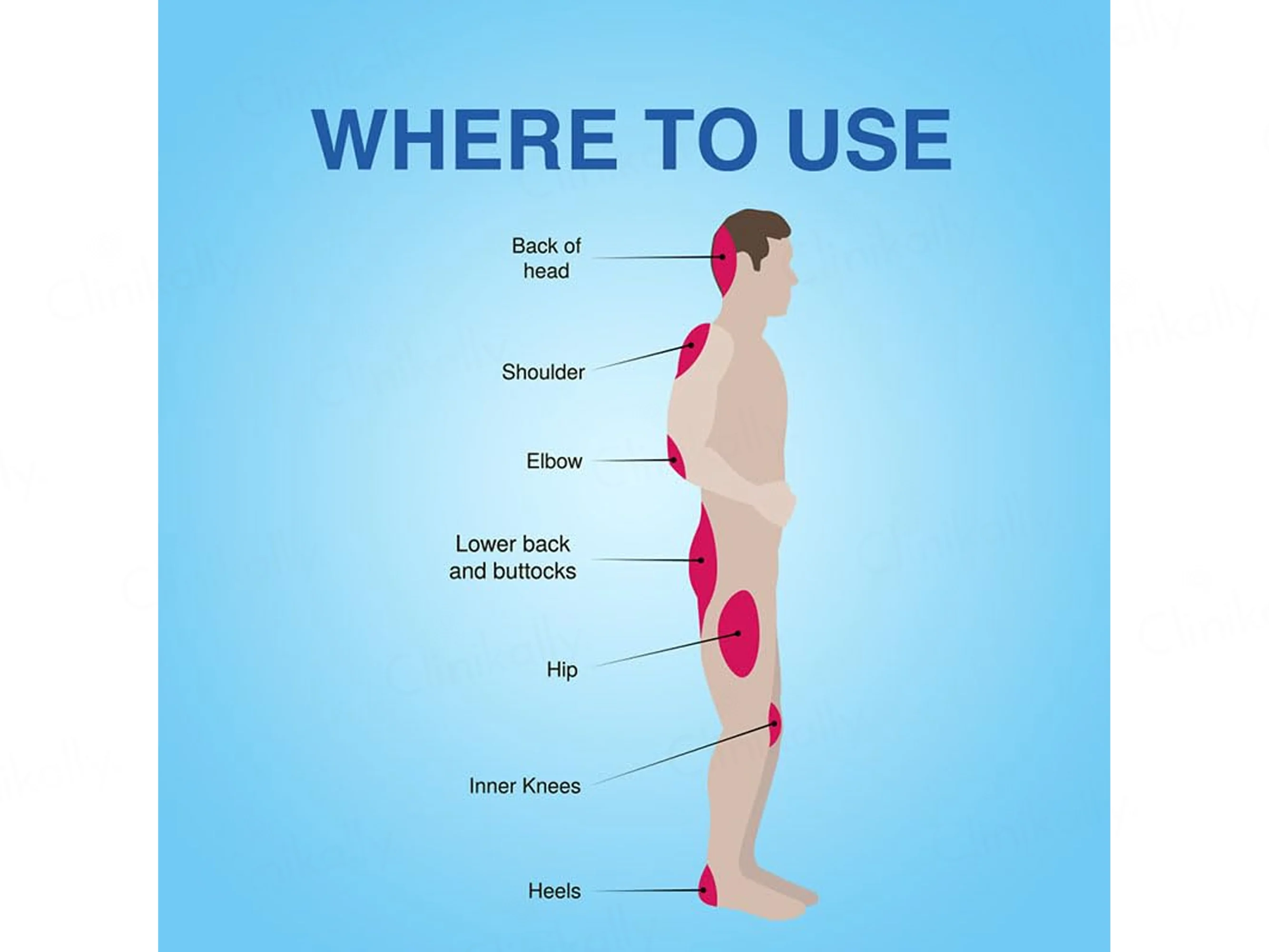 Soreze Silicone Barrier Gel - Image 8