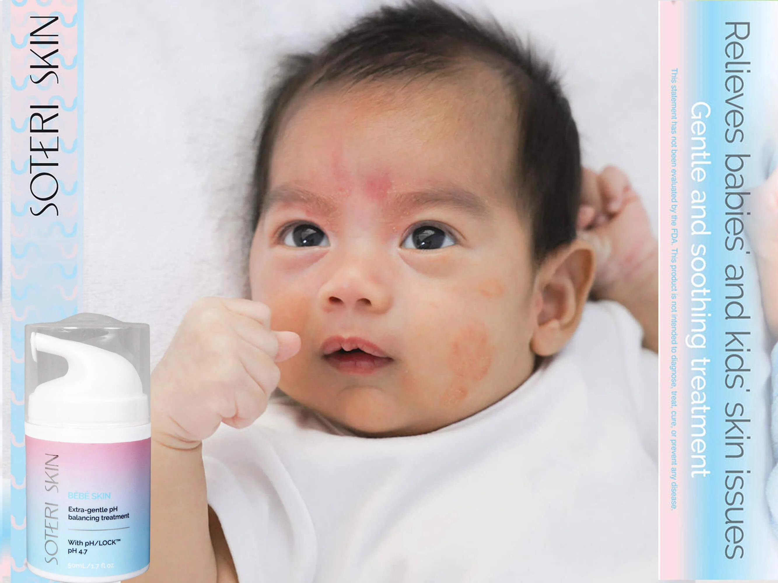 Soteri Skin BEBE Skin - Image 5