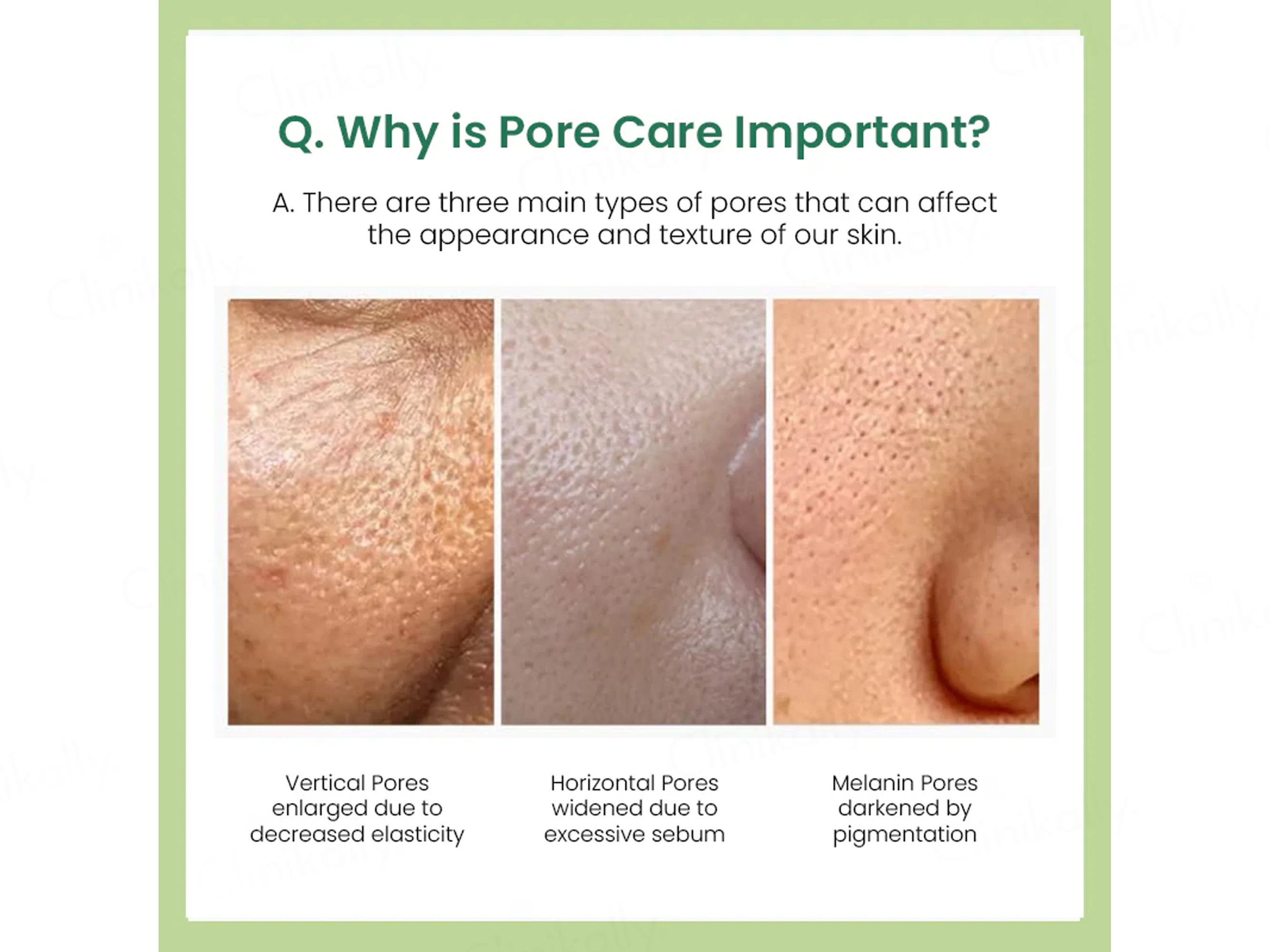 Sungboon Editor Green Tomato Pore Lifting Ampoule Toner - Image 3