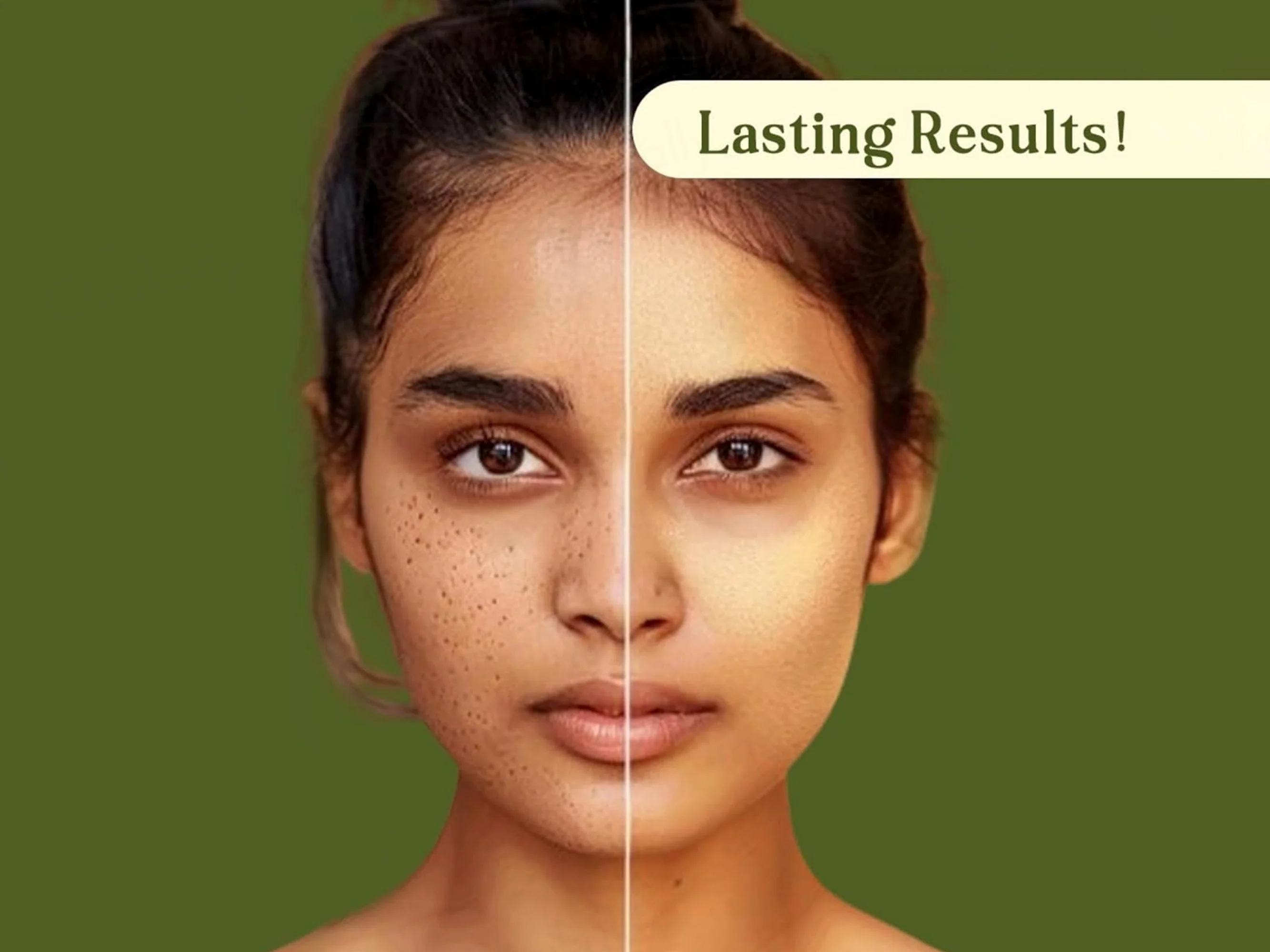 Suun Ayurveda Phyto Pore Refiner Face Serum - Image 6