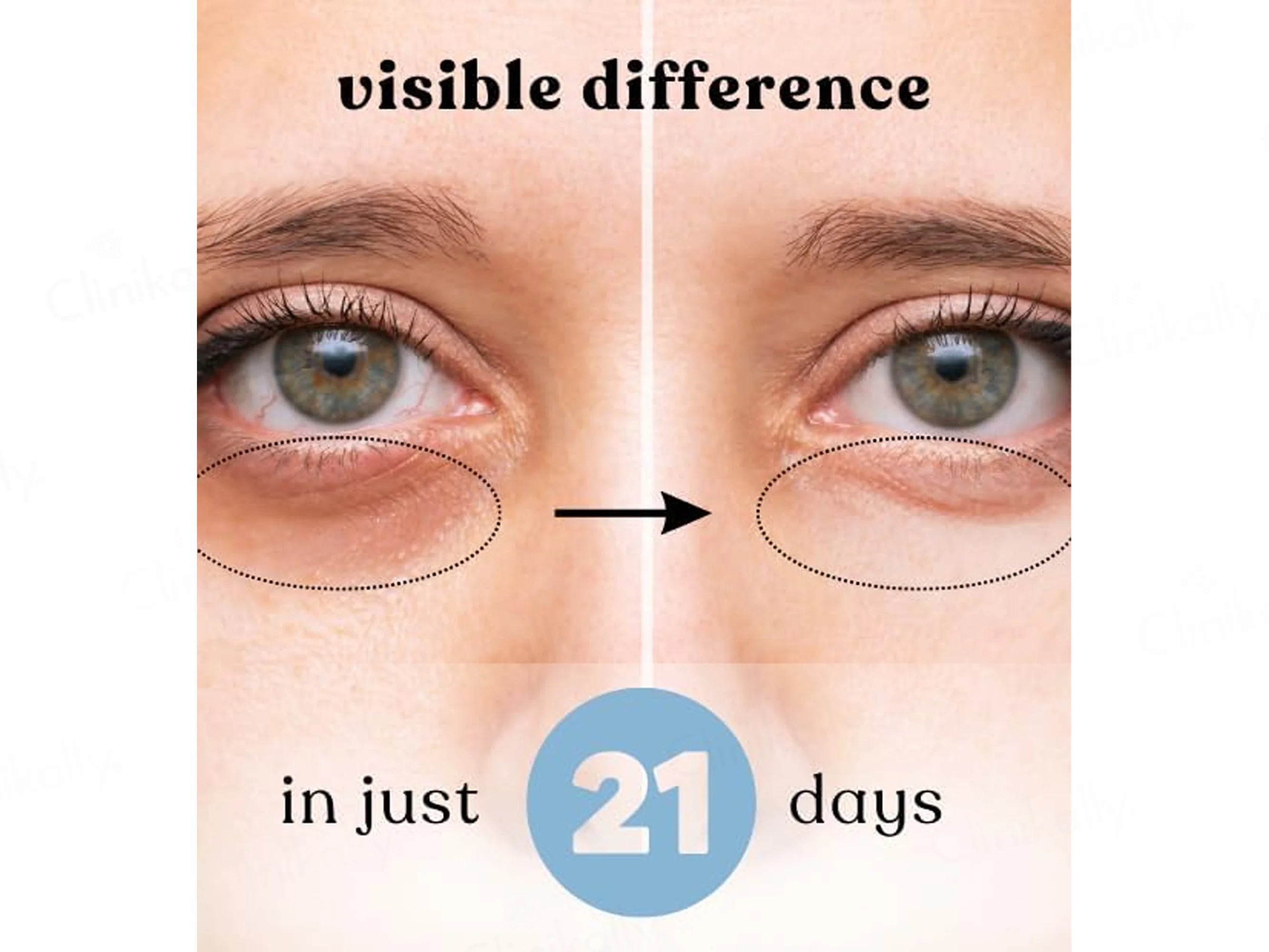 The CuraTeam Ezyroll Rejuvenating Under Eye Serum - Image 4