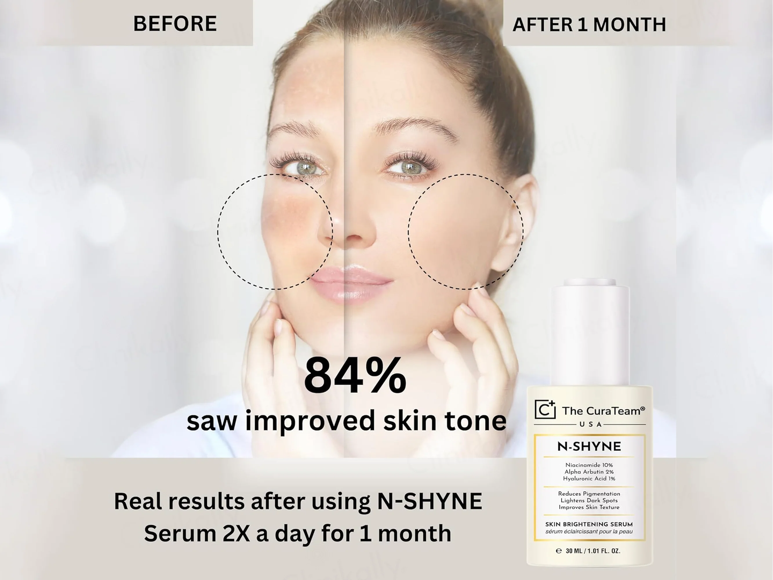 The CuraTeam N-Shyne Skin Brightening Serum - Image 4