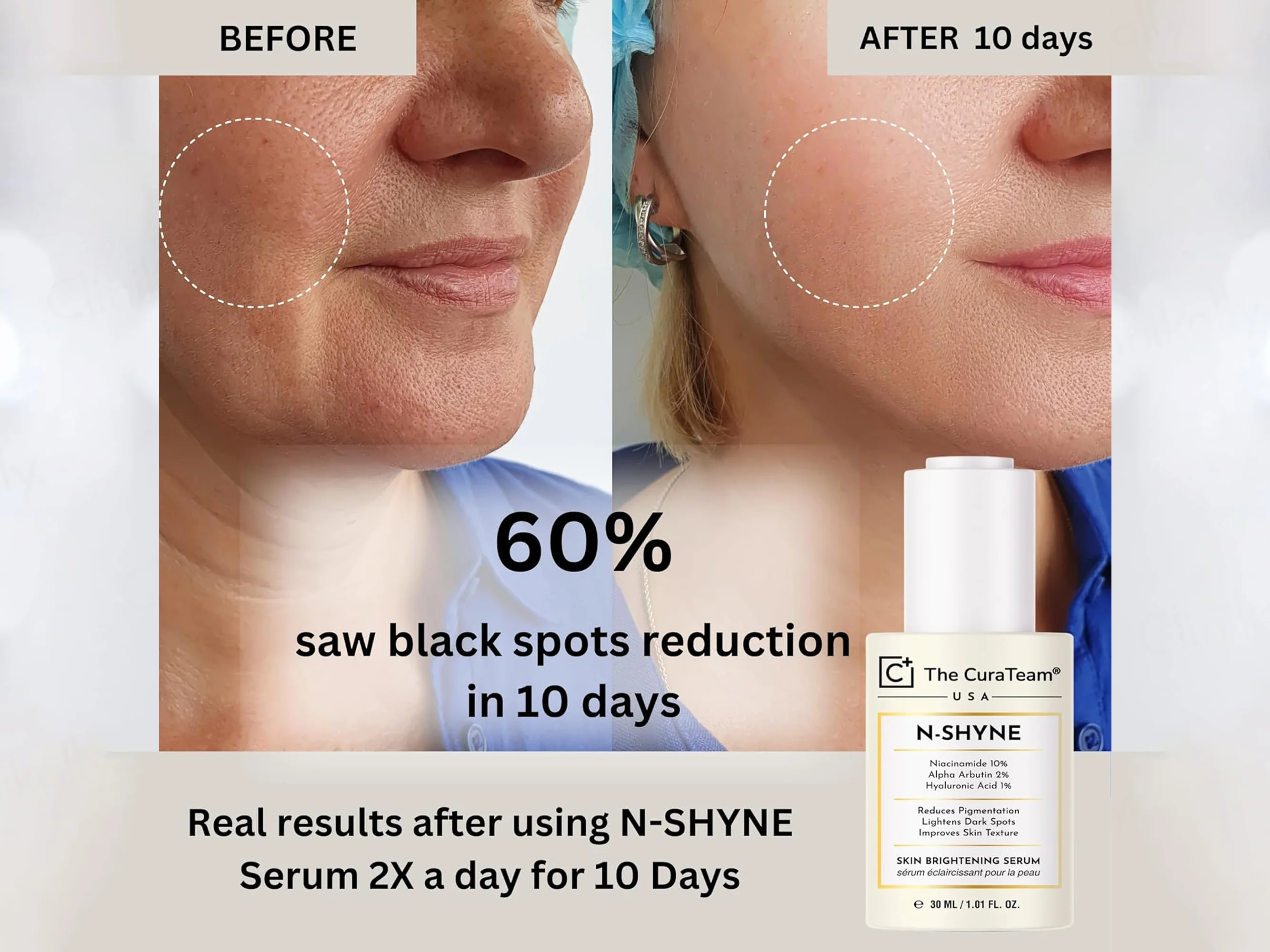 The CuraTeam N-Shyne Skin Brightening Serum - Image 5