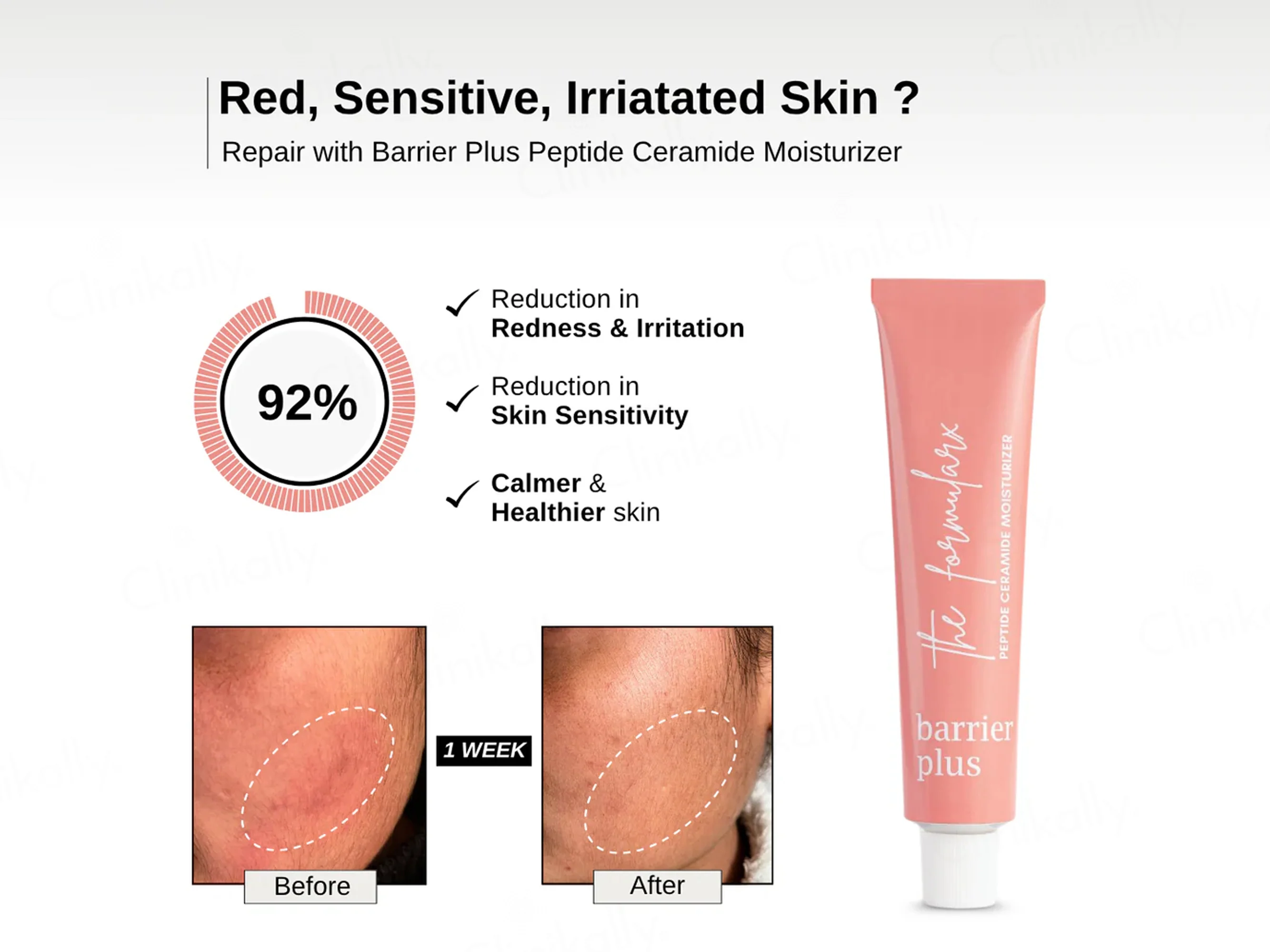 The FormulaRx Barrier Plus Peptide Ceramide Moisturizer - Image 4