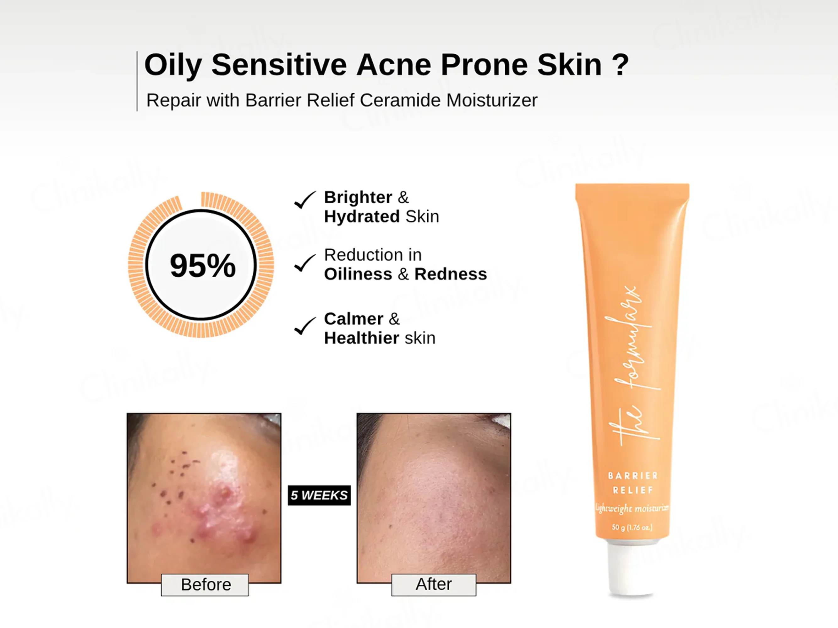 The FormulaRx Barrier Relief Lightweight Ceramide Moisturizer - Image 4
