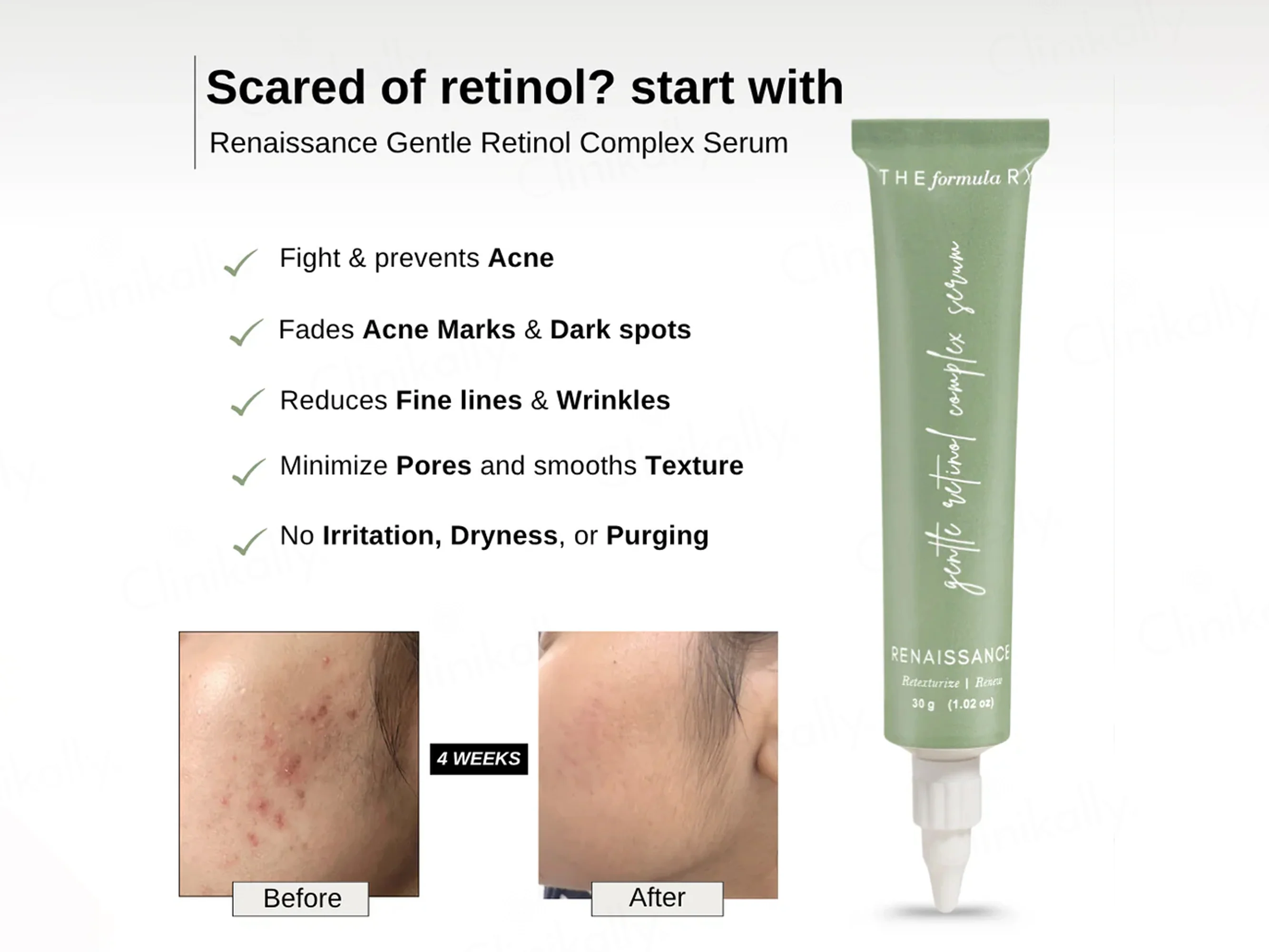 The FormulaRx Renaissance Gentle Retinol Complex Serum - Image 4