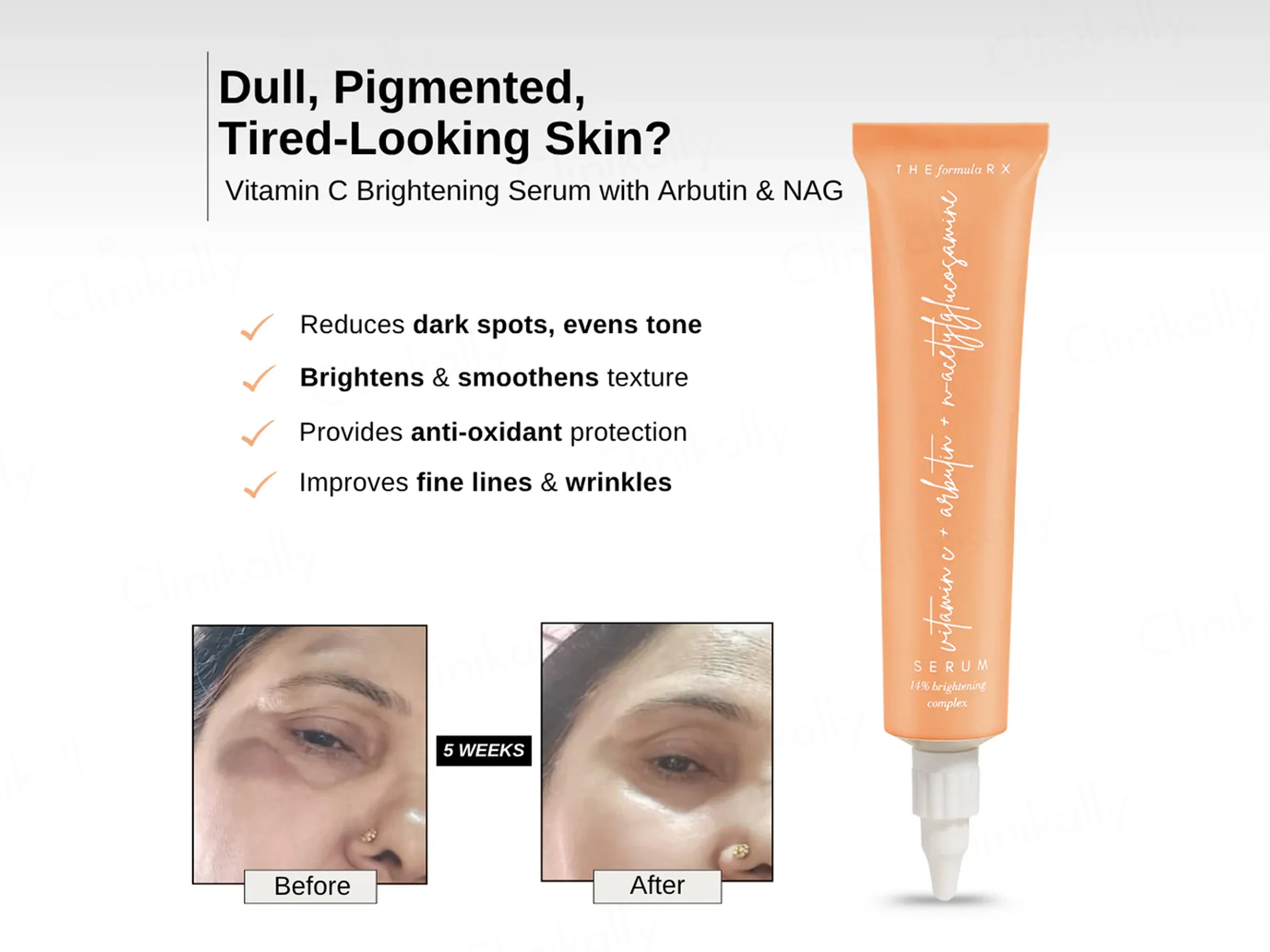 The FormulaRx Vitamin C Brightening Serum - Image 4