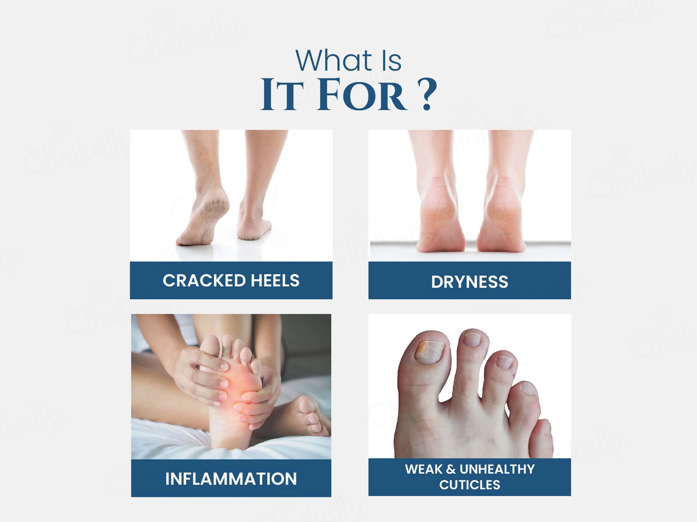 Uniqaya Foot Care Cream - Image 5