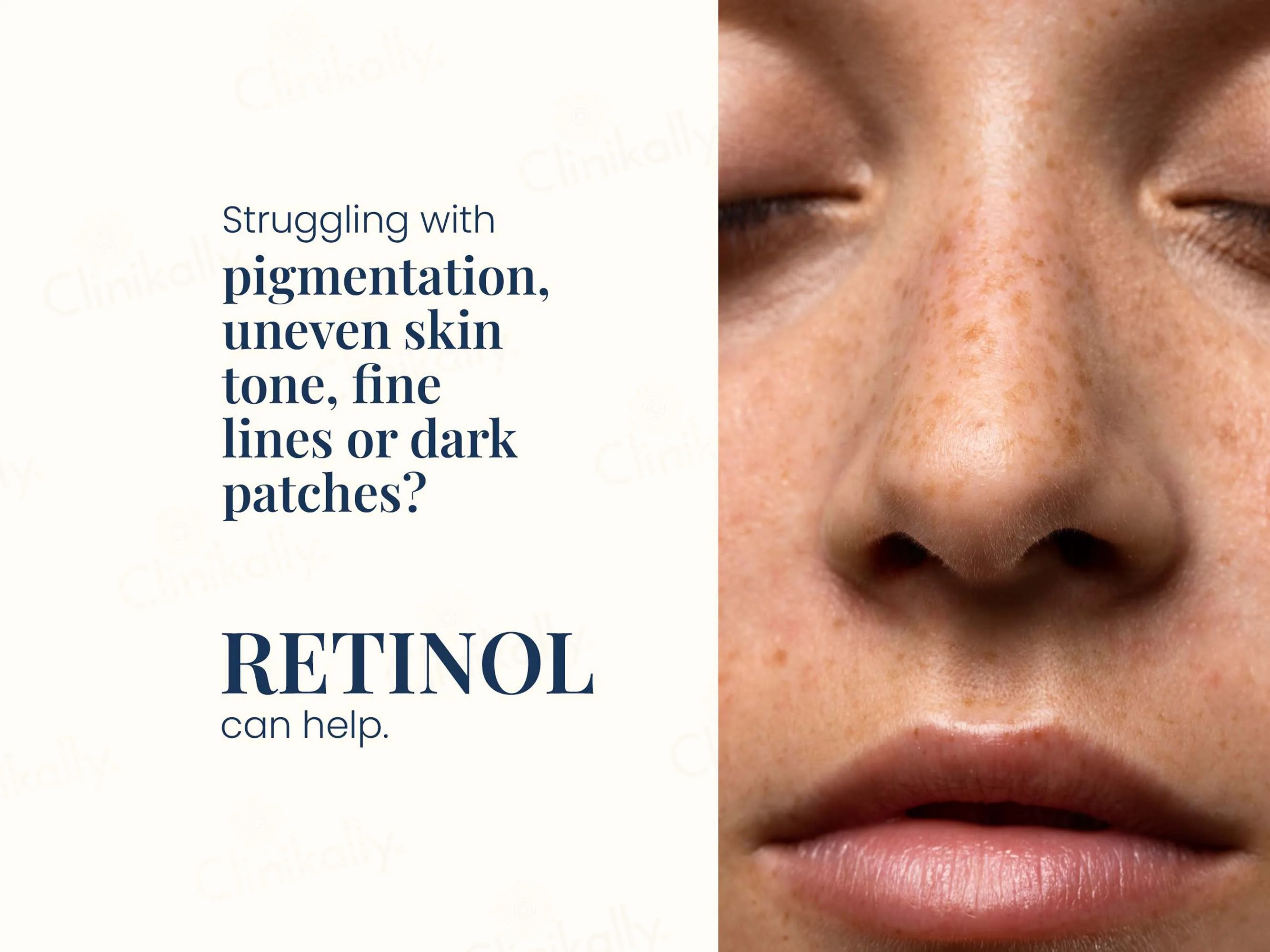 Uniqaya Retinol Serum - Image 5