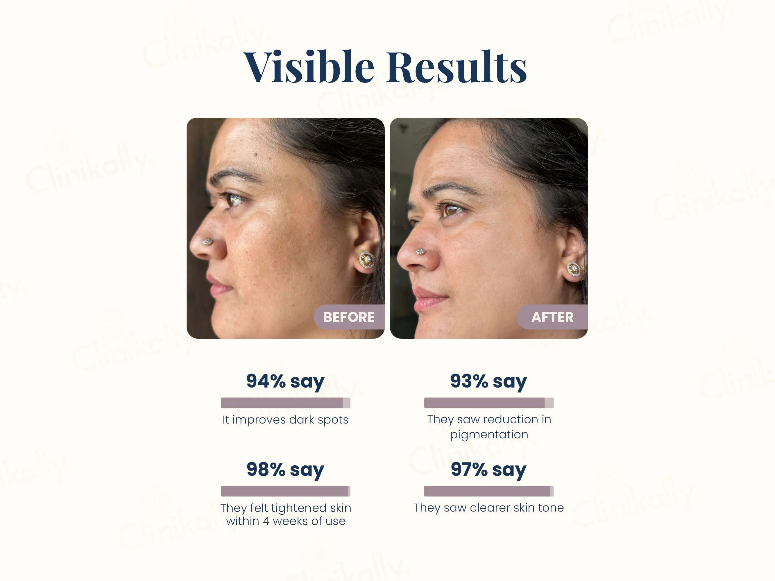Uniqaya Retinol Serum - Image 6