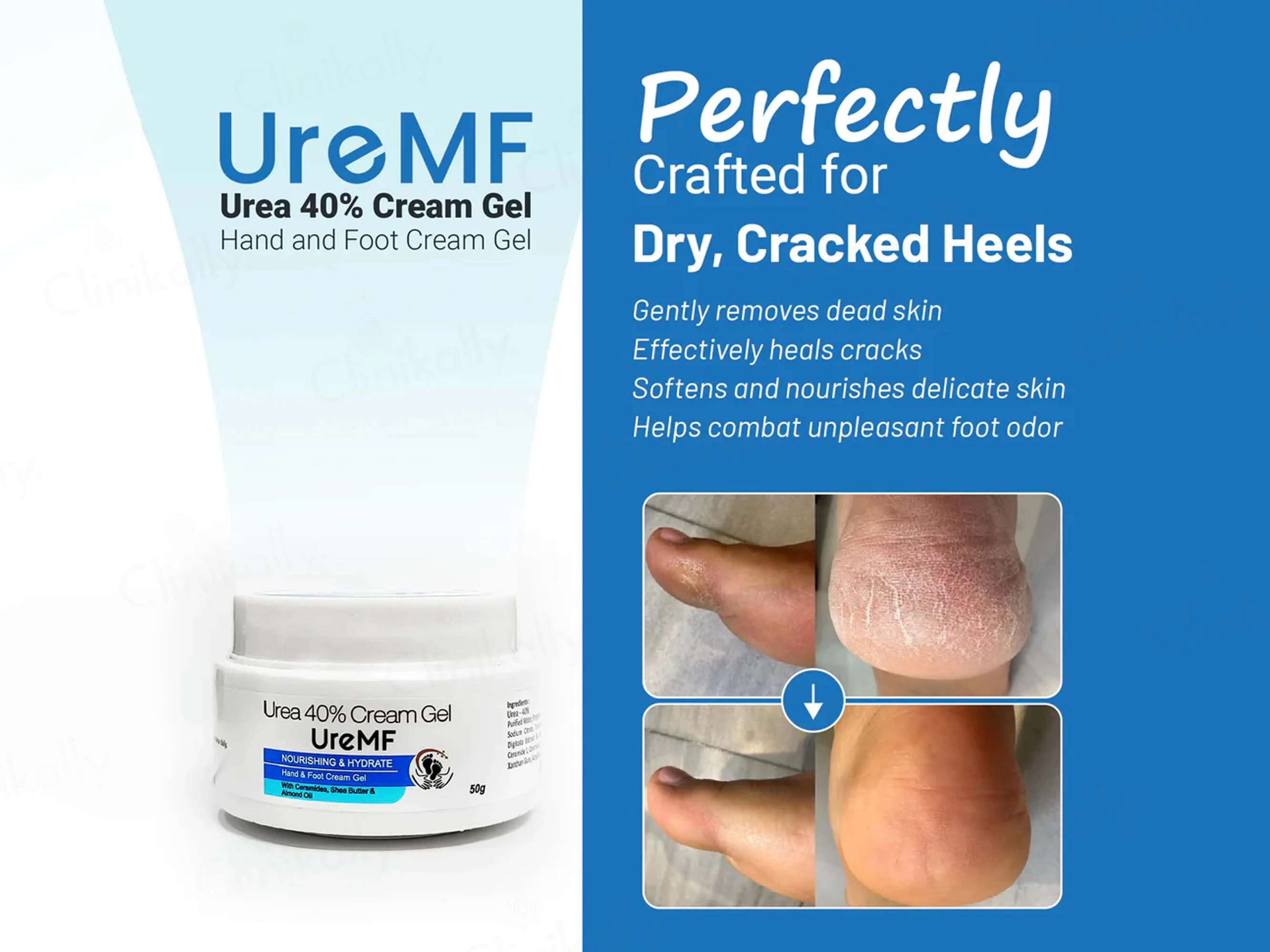 UreMF 40% Urea Hand & Foot Cream Gel - Image 6