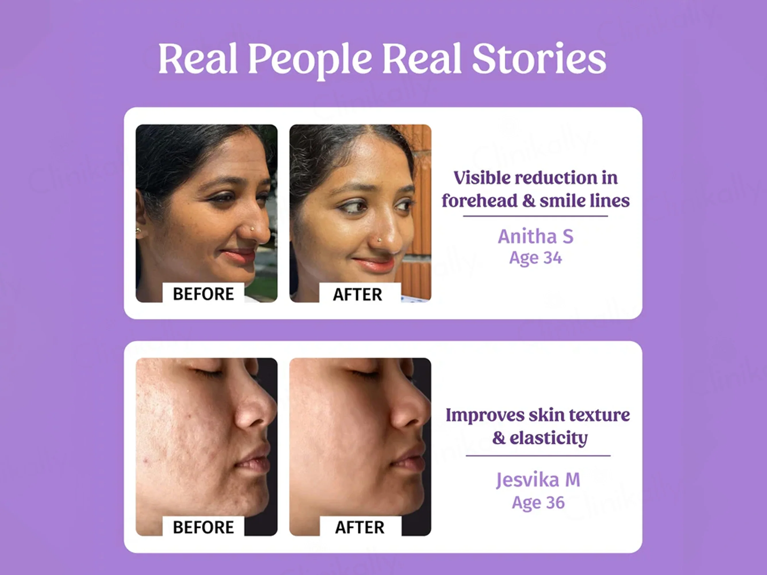 Vilvah Store Better Ageing Overnight Skin Renewal Face Serum - Image 5