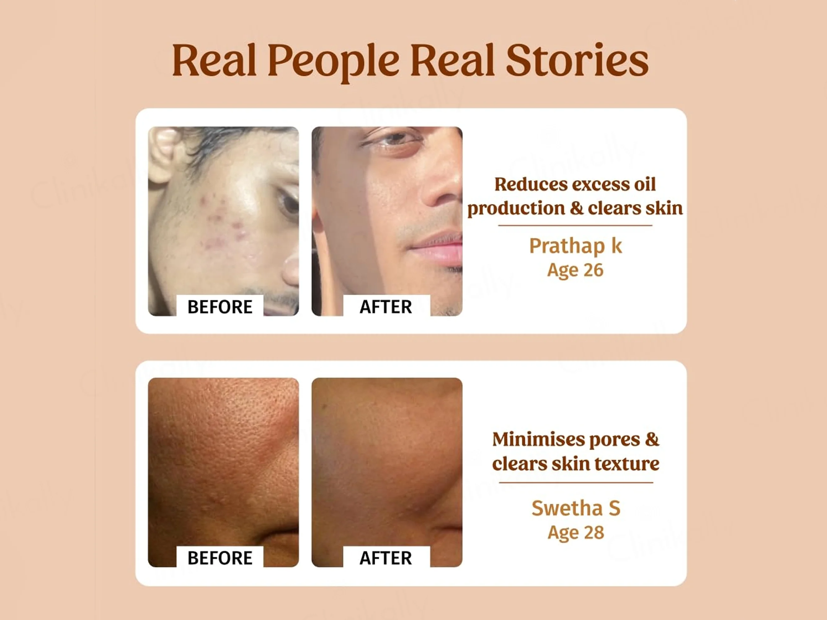Vilvah Store Milk Facial Toner - Image 3