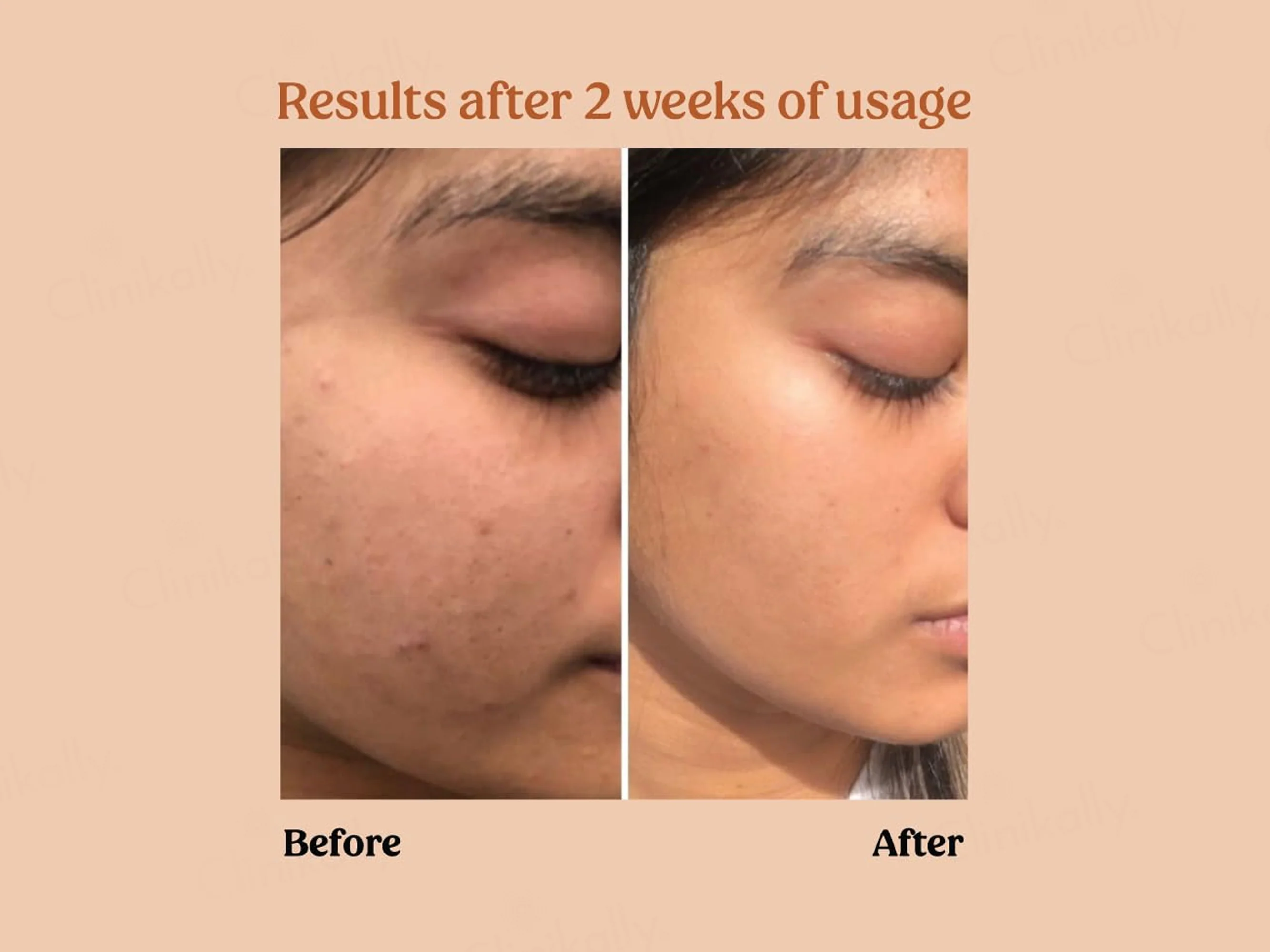 Vilvah Store Milk Powder Face Wash - Image 5