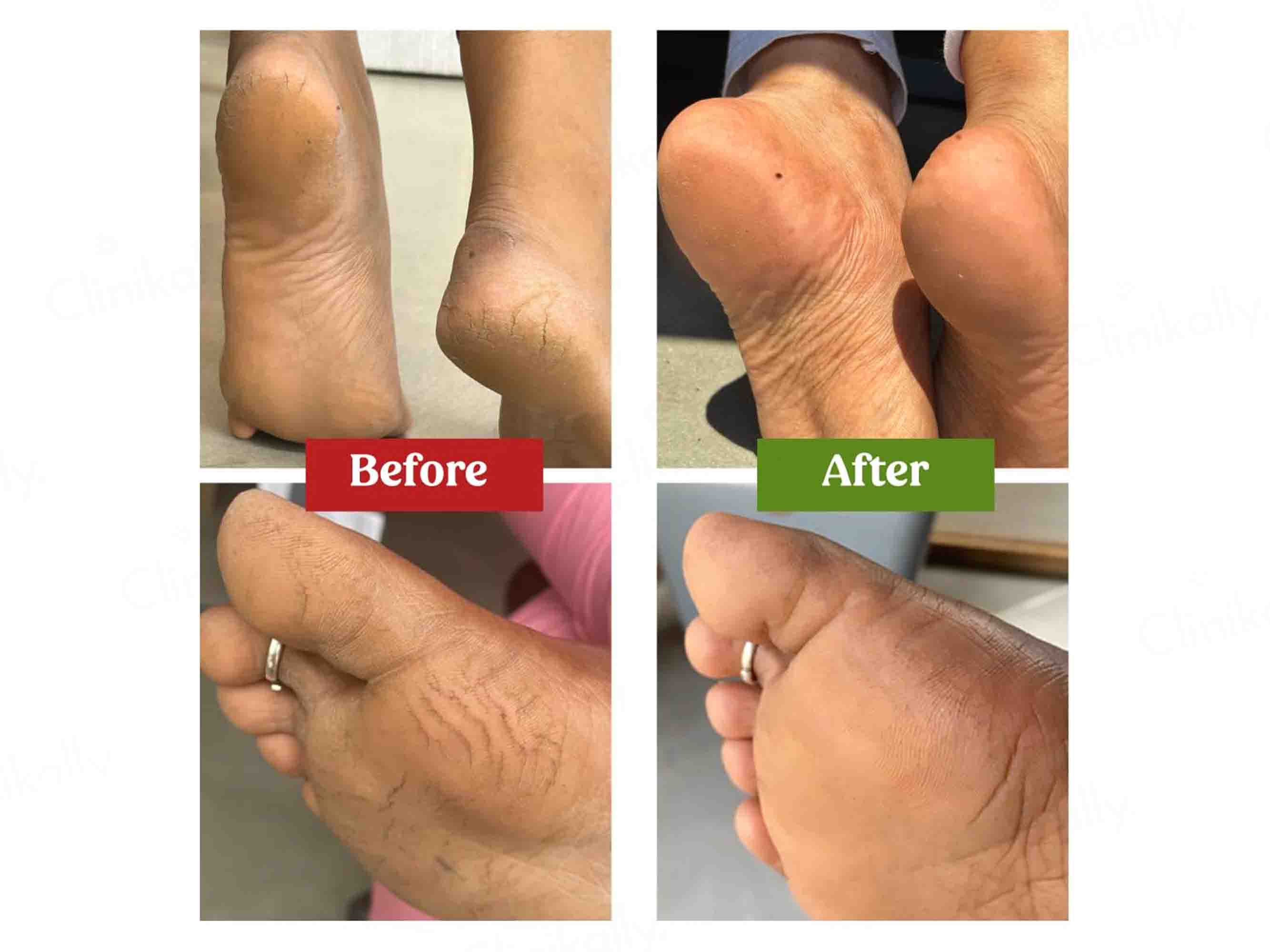 Vilvah Store Moisturizing Foot Cream - Image 8