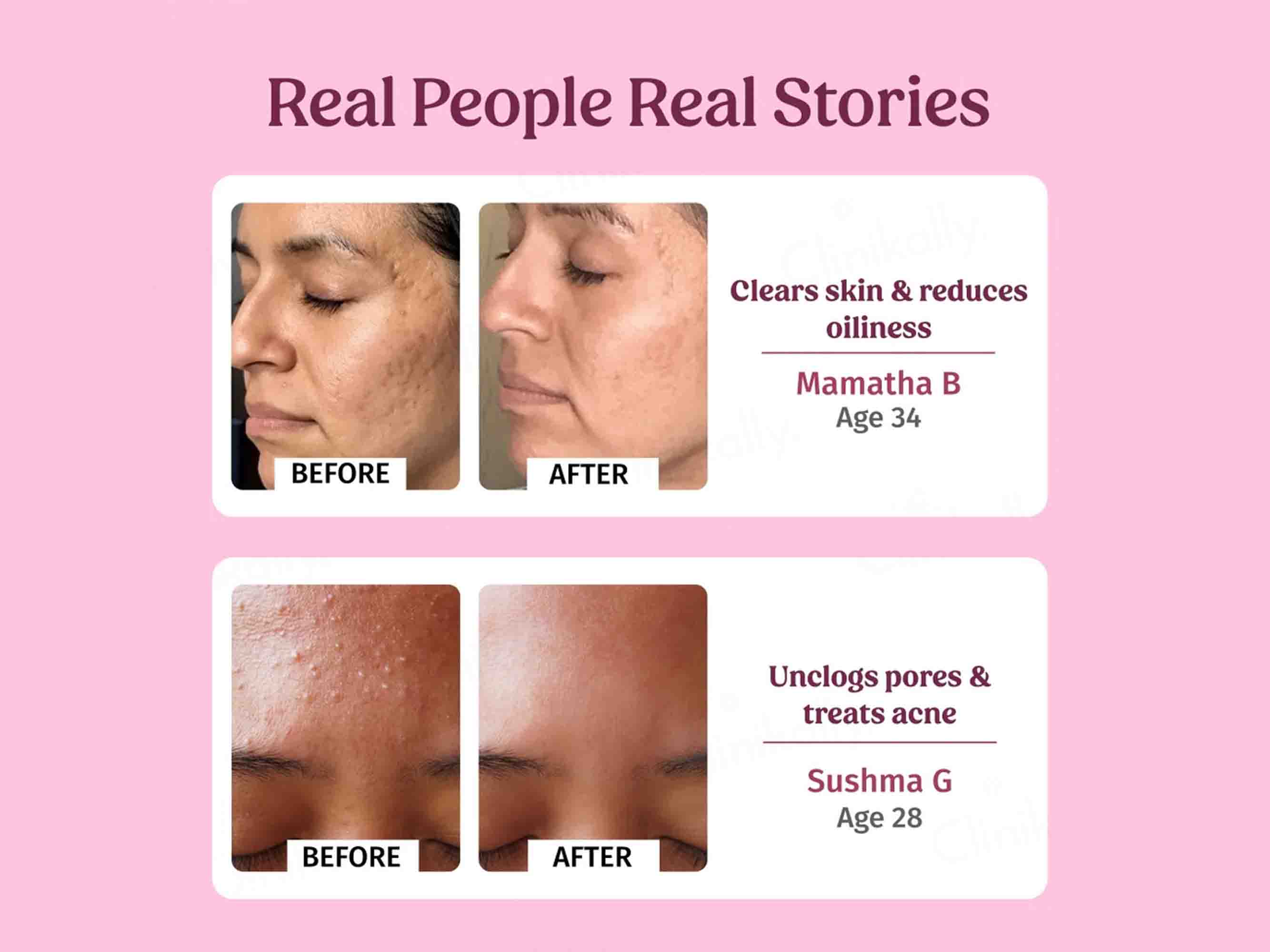 Vilvah Store Pure Rose Water Facial Toner - Image 5