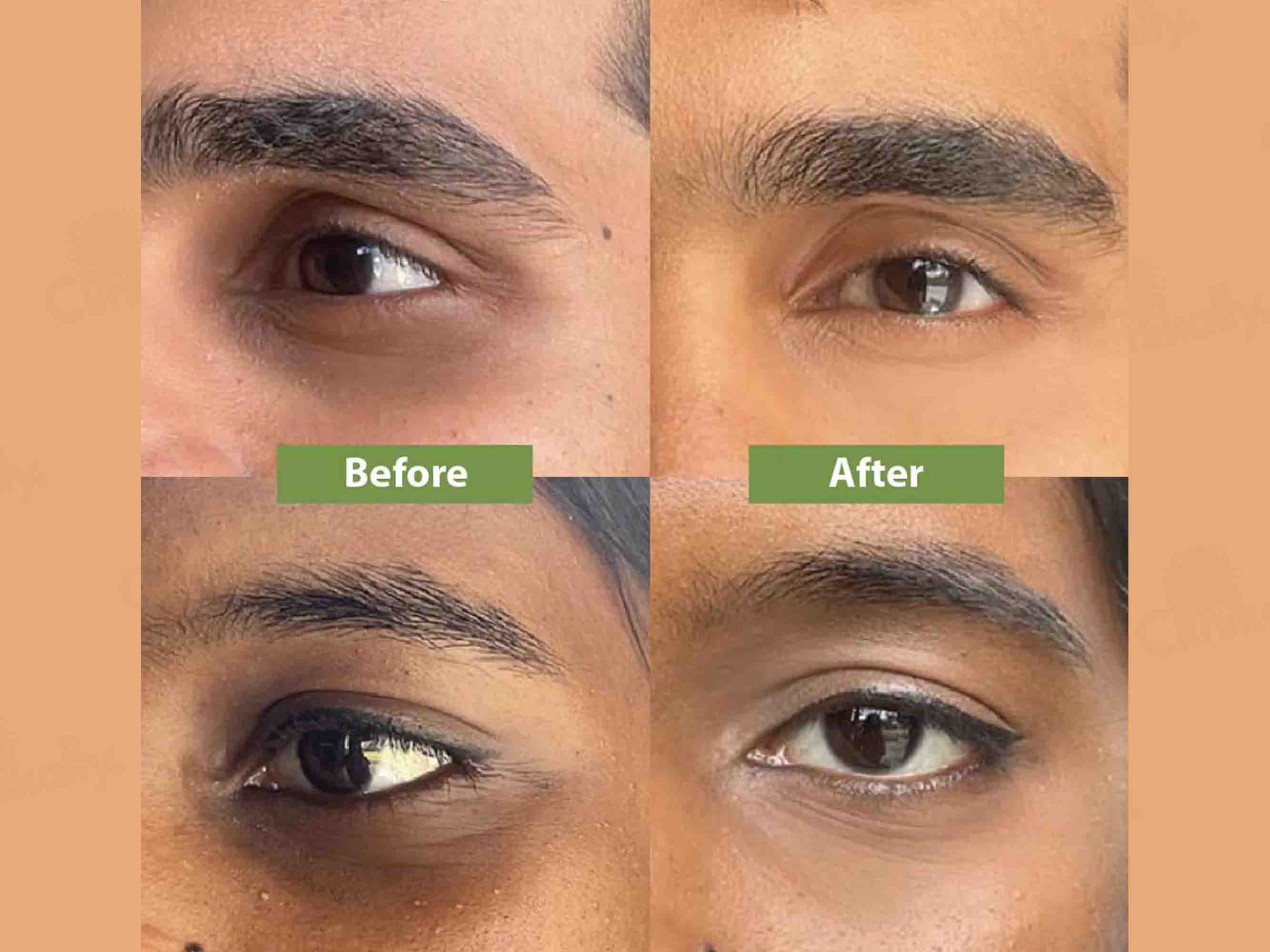 Vilvah Store Under Eye Cream For Dark Circle Control - Image 4