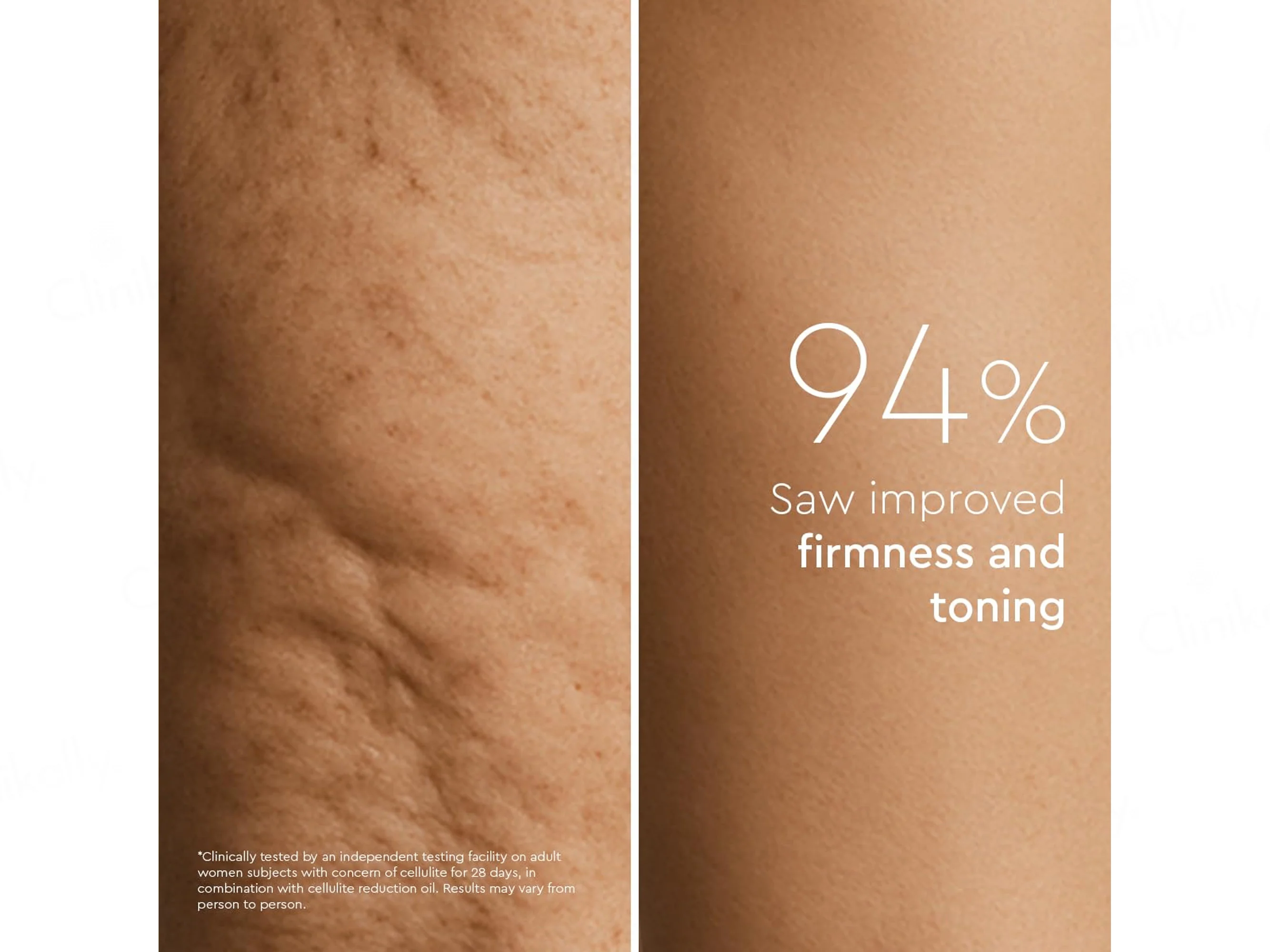 VLCC Clinic Prosculpt Cellulite Reduction Gel - Image 8