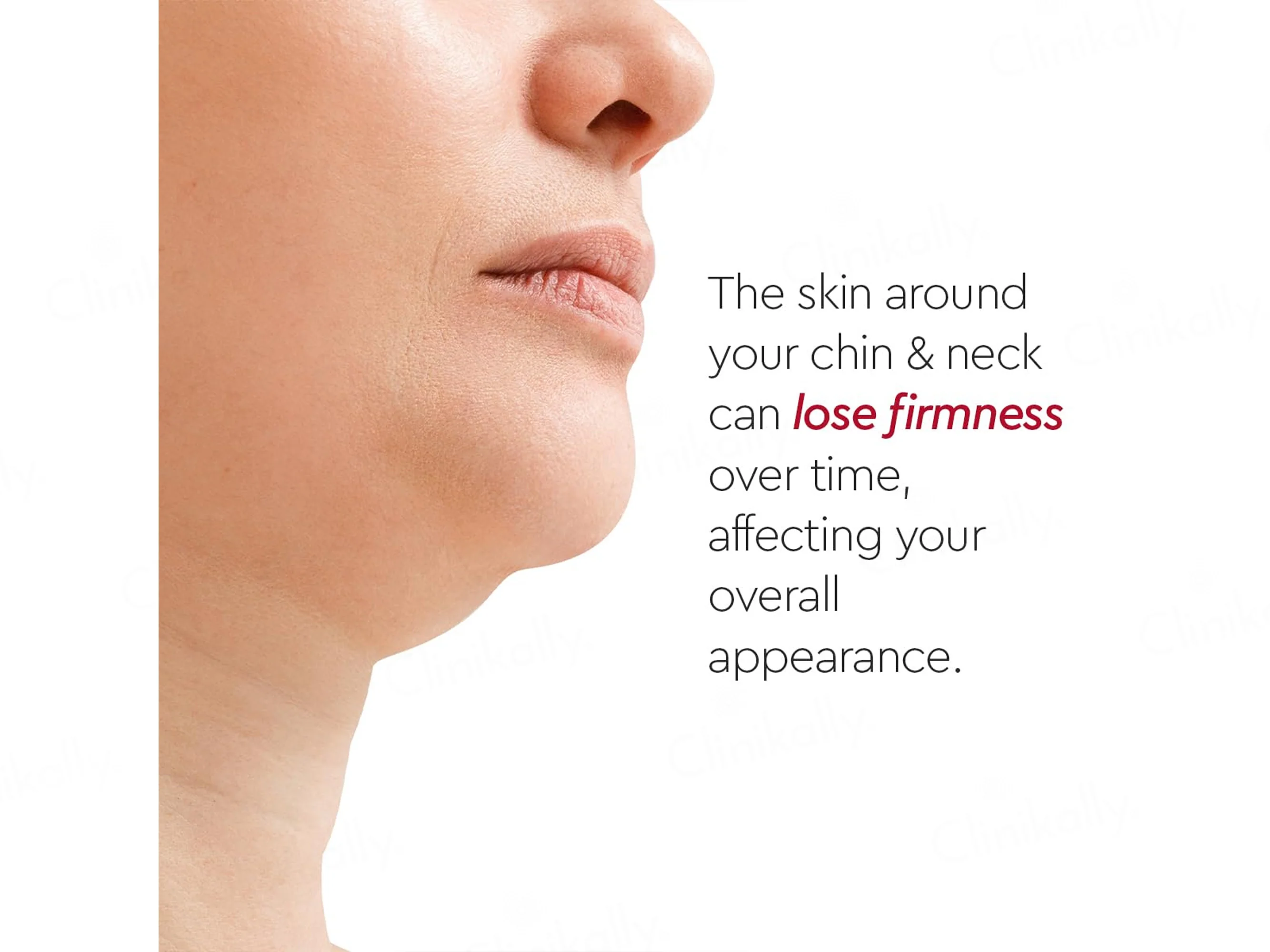 VLCC Clinic Prosculpt Chin & Neck Line Firming Cream - Image 5