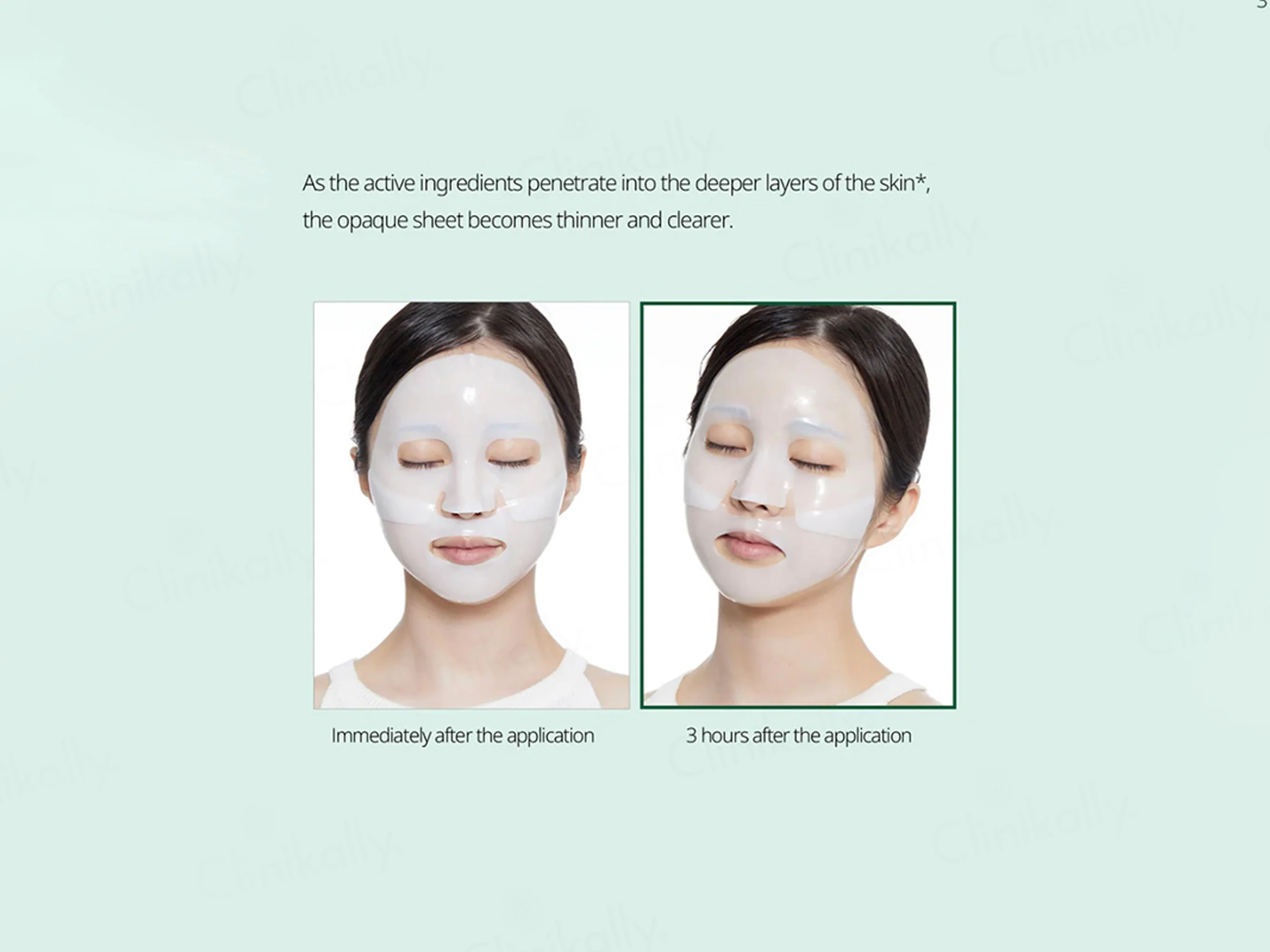 VT Cosmetics 100 Pro Cica Reedle Shot 2-Step Hydrogel Face Mask Kit - Image 4