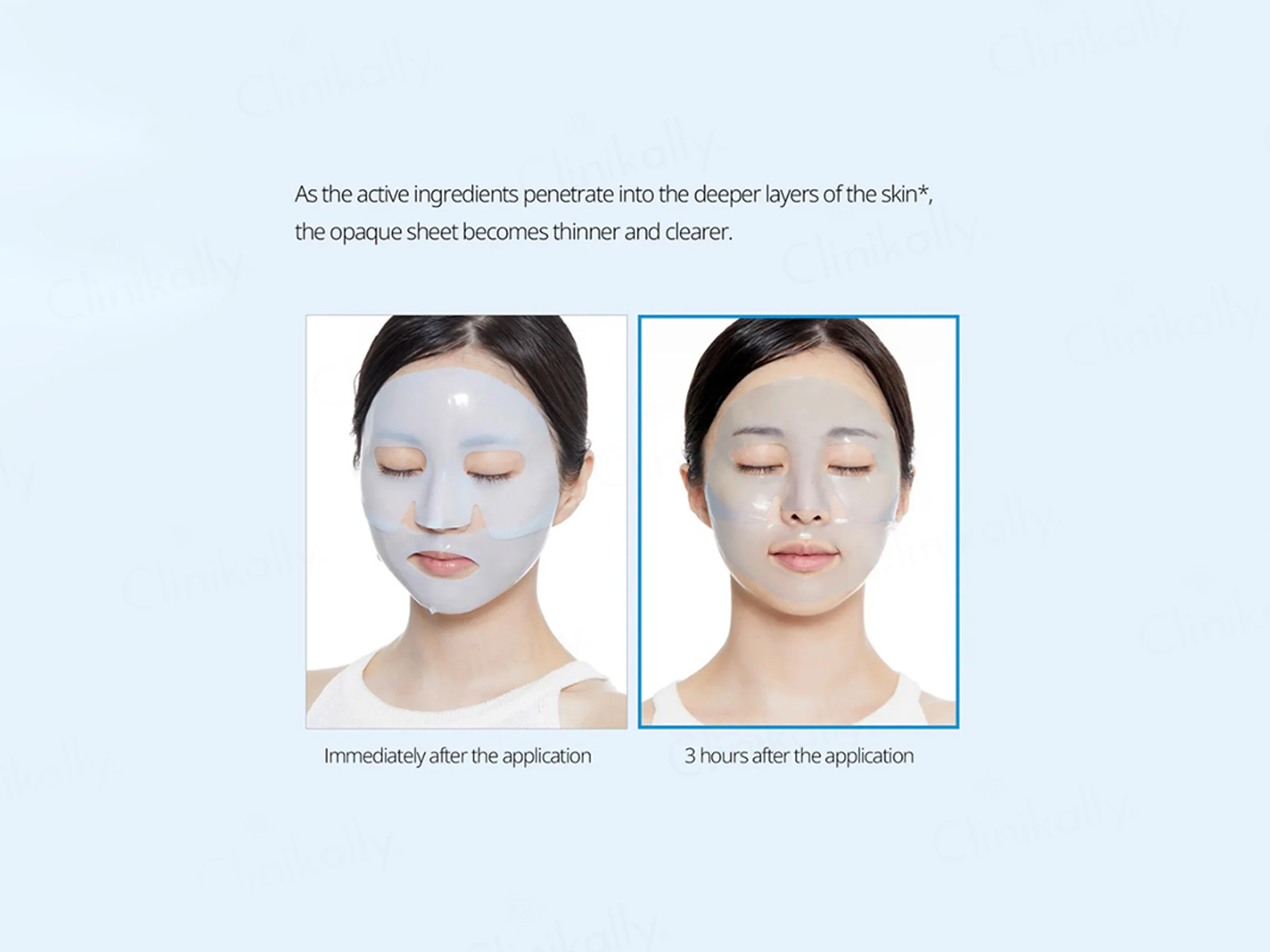VT Cosmetics 100hL Hydrop Reedle Shot 2-Step Hydrogel Face Mask Kit - Image 4