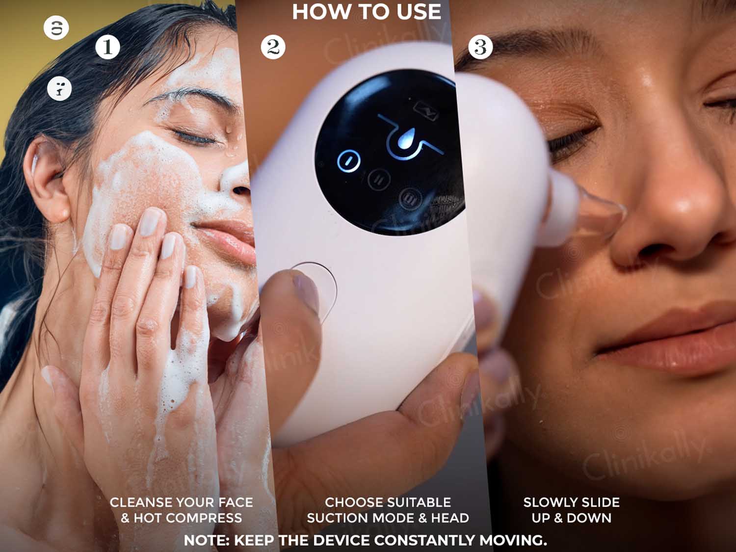 Winston Blackhead Remover - Image 5