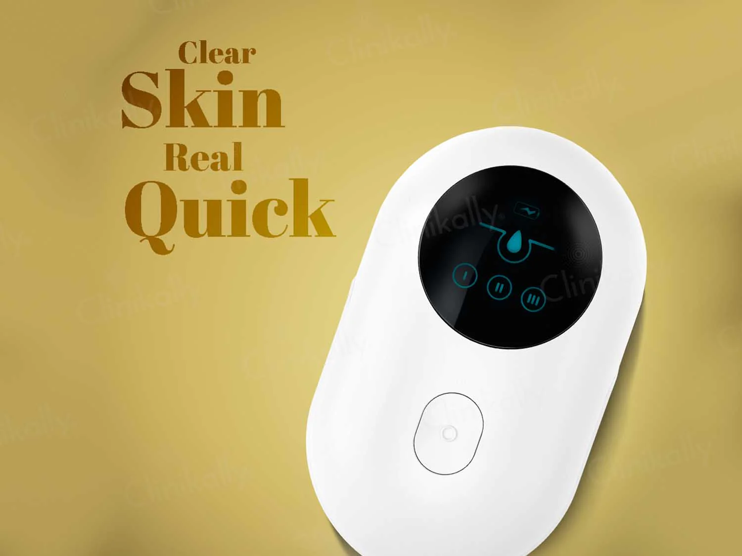 Winston Blackhead Remover - Image 6
