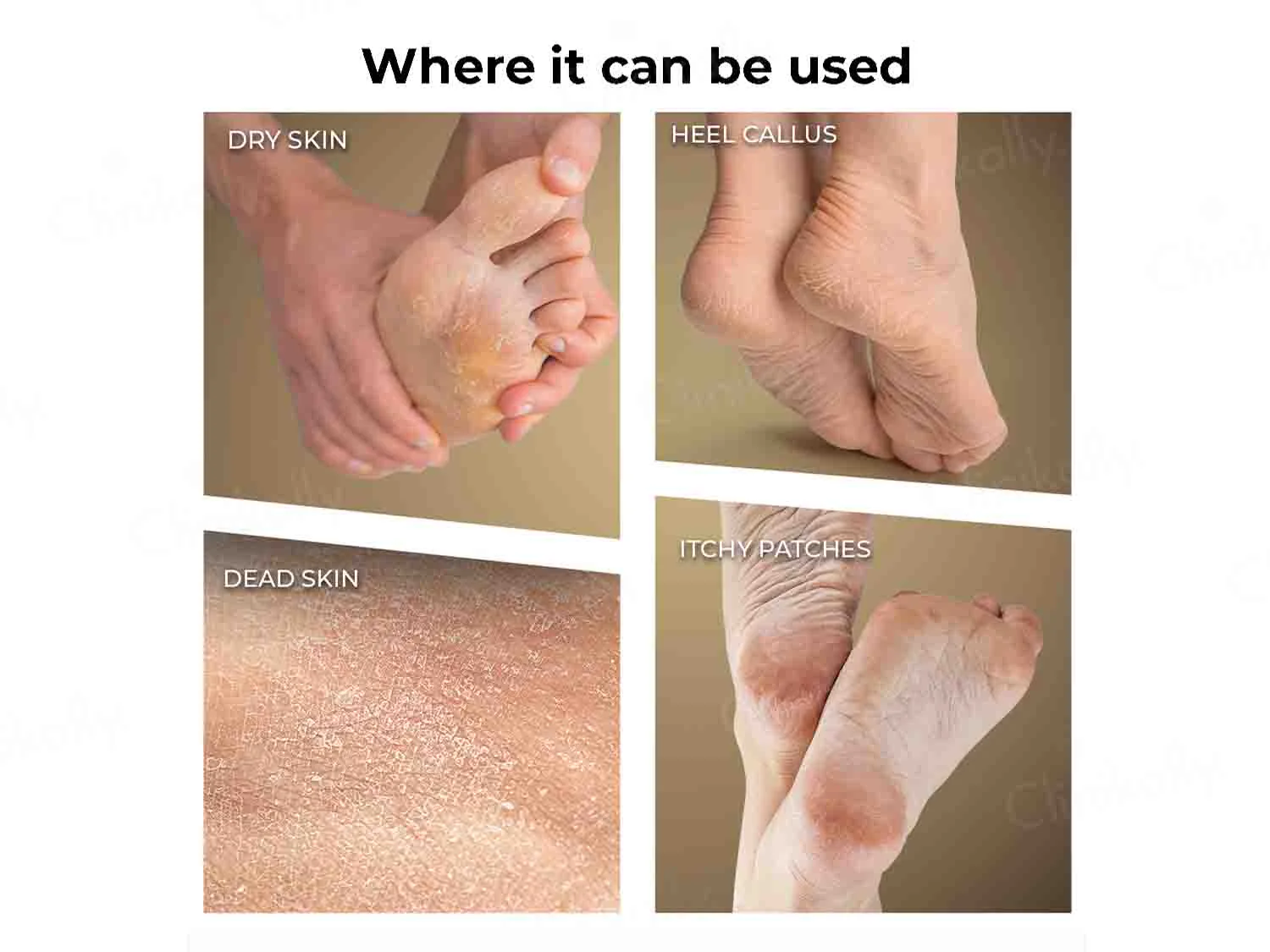 Winston Callus Remover - Image 3