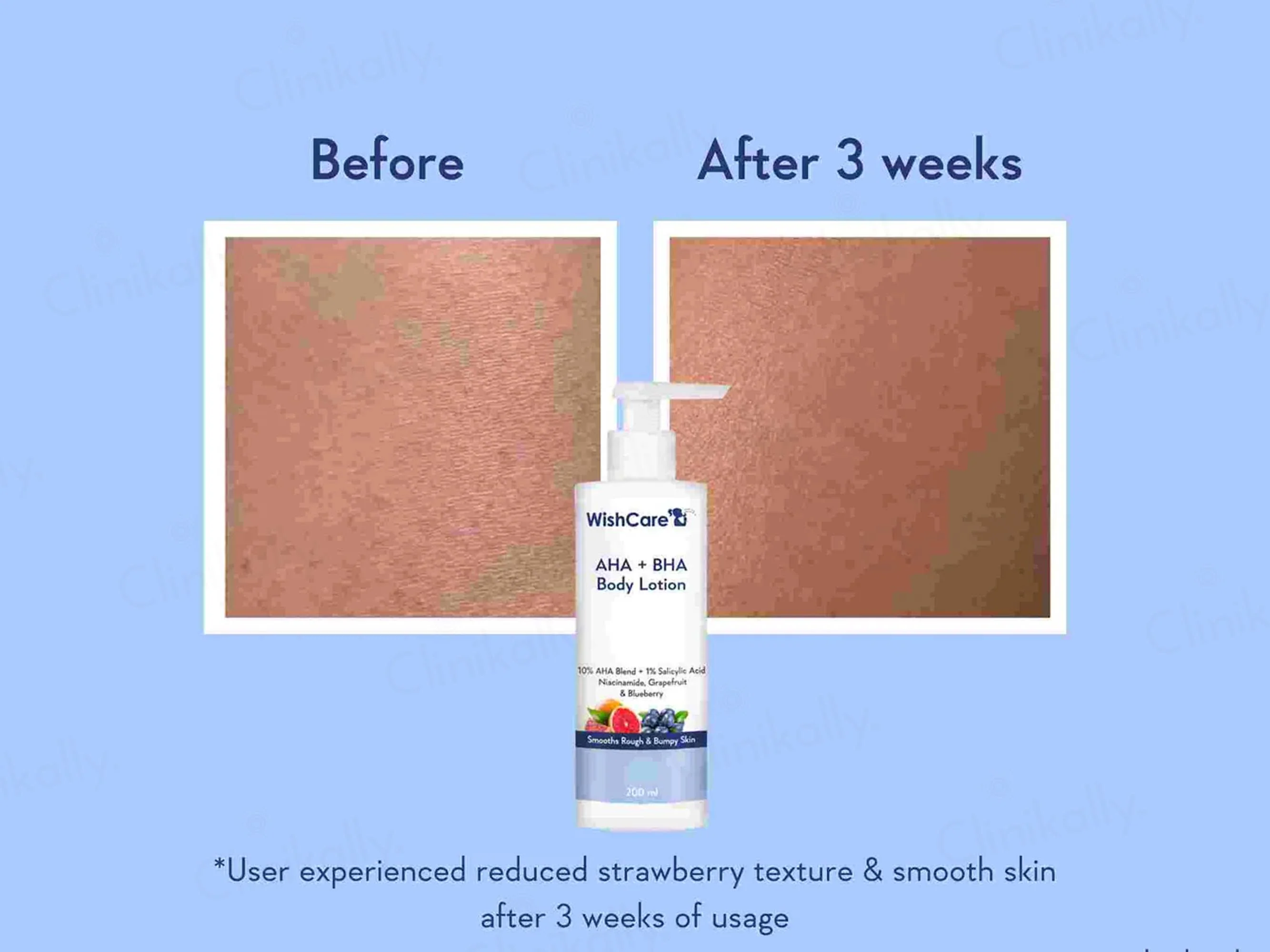 WishCare AHA + BHA Body Lotion - Image 6