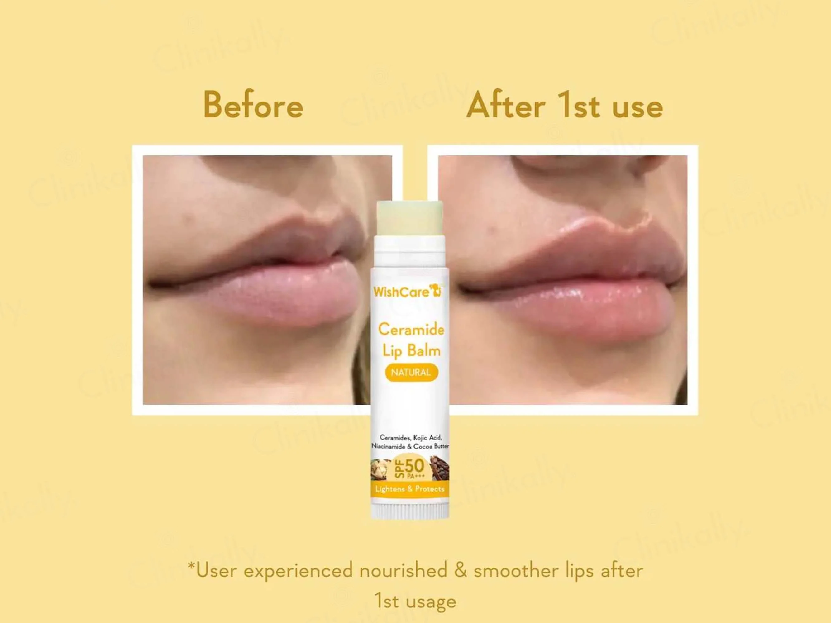 WishCare Ceramide Lip Balm - Natural SPF 50 PA+++ - Image 5