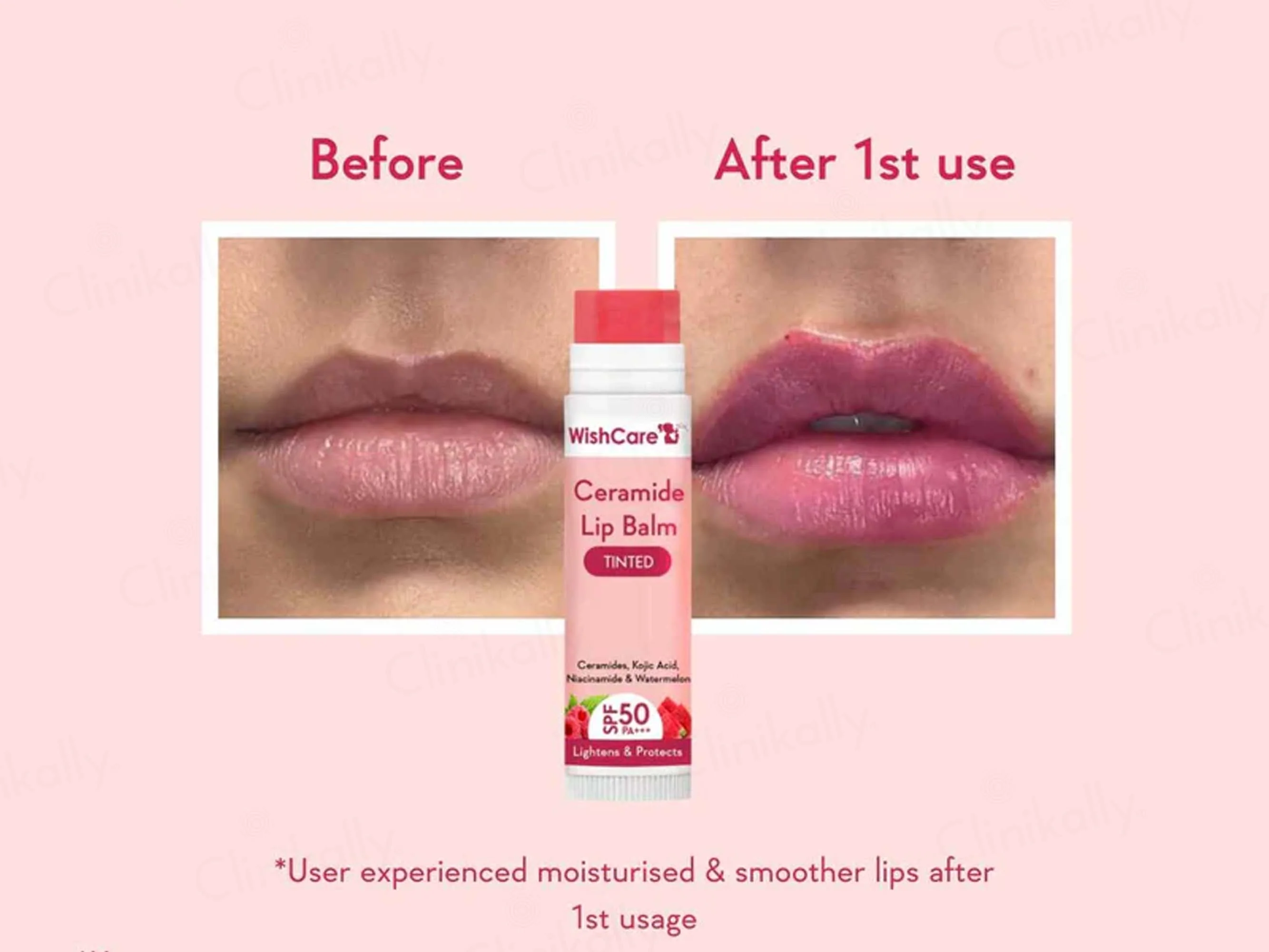 WishCare Ceramide Lip Balm - Tinted SPF 50 PA+++ - Image 5