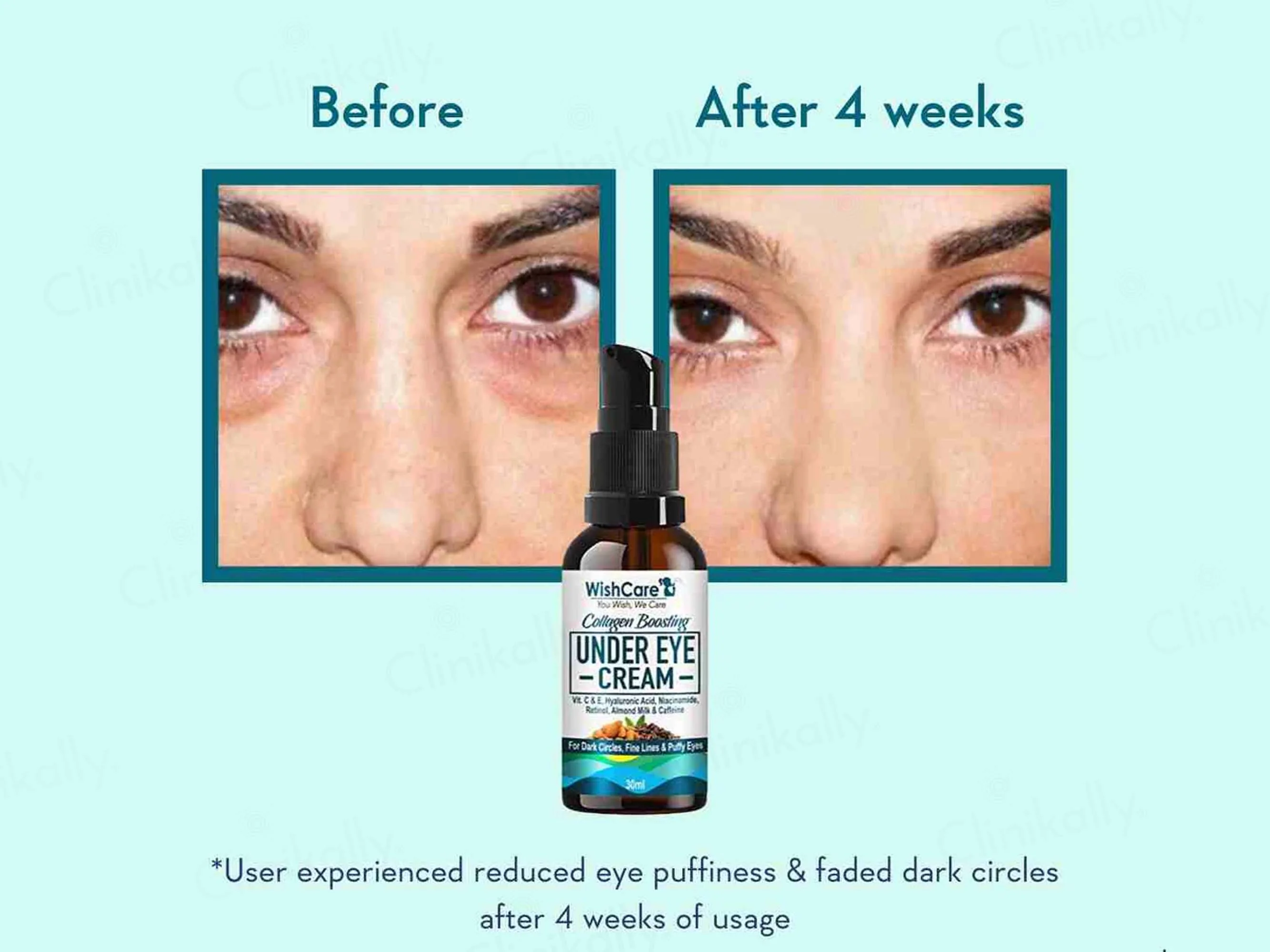 WishCare Collagen Boosting Under Eye Cream - Image 5