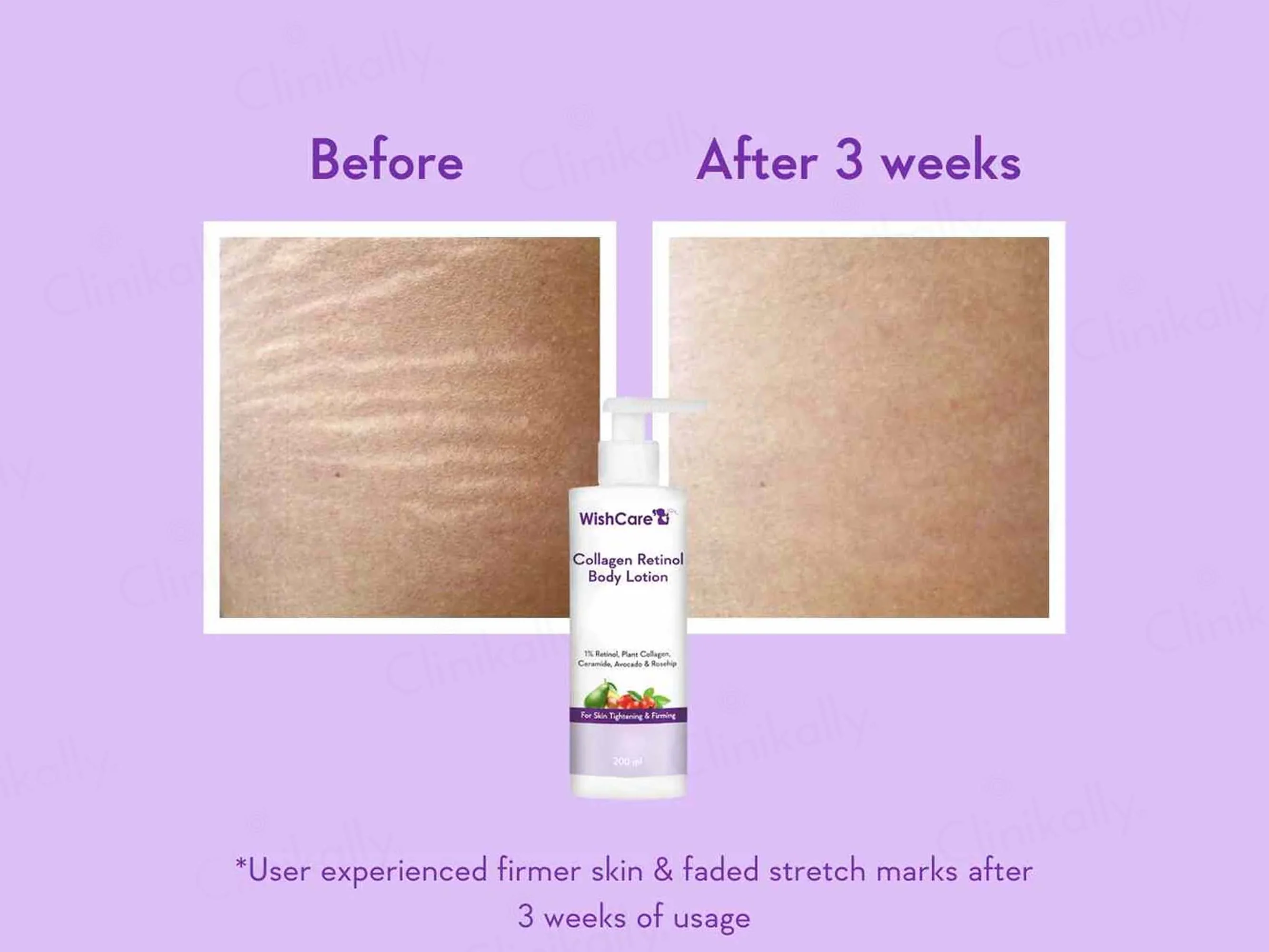 WishCare Collagen Retinol Body Lotion - Image 5
