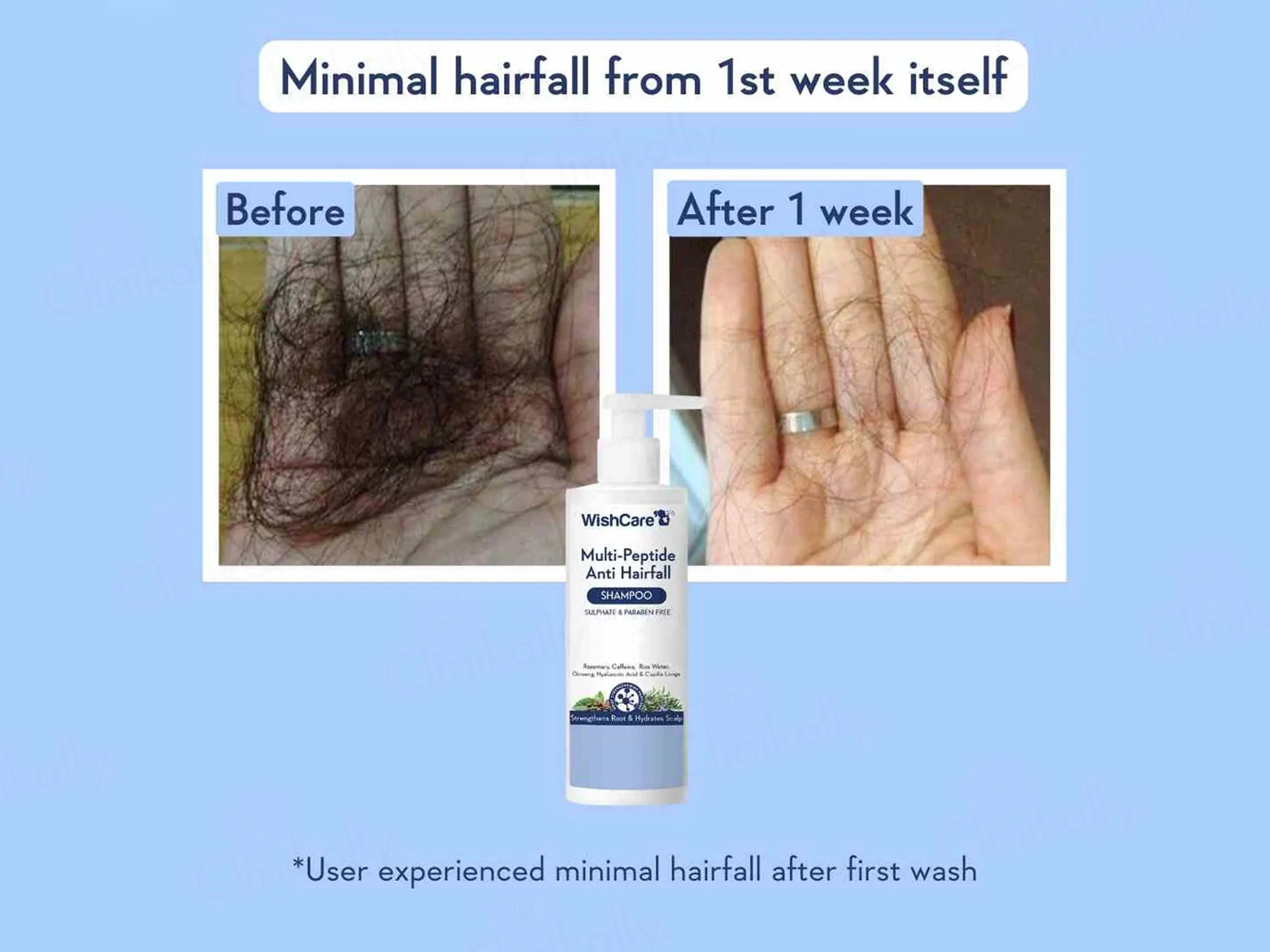 WishCare Multi-Peptide Anti Hairfall Shampoo - Image 5
