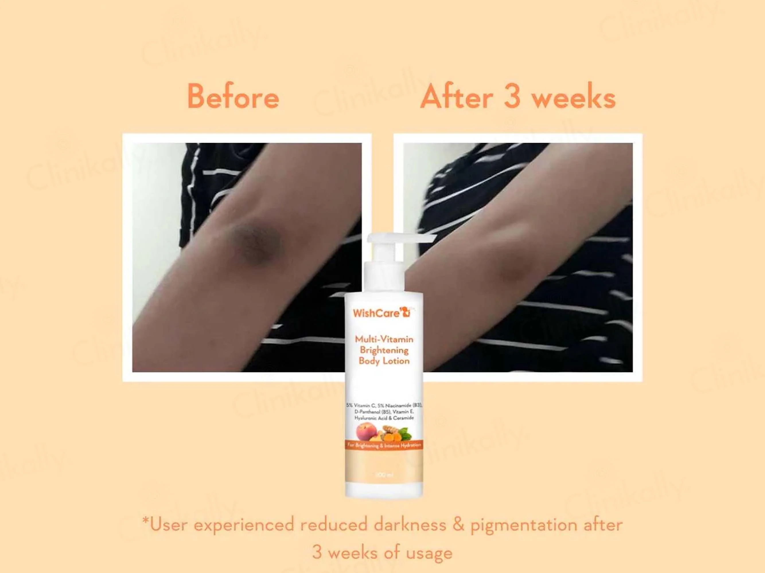 WishCare Multi-Vitamin Brightening Body Lotion - Image 5
